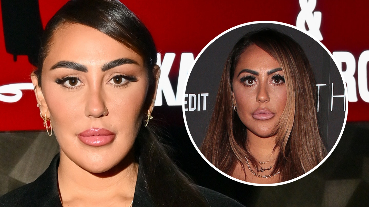 Sophie Kasaei shows off 'natural' look after dissolving fillers