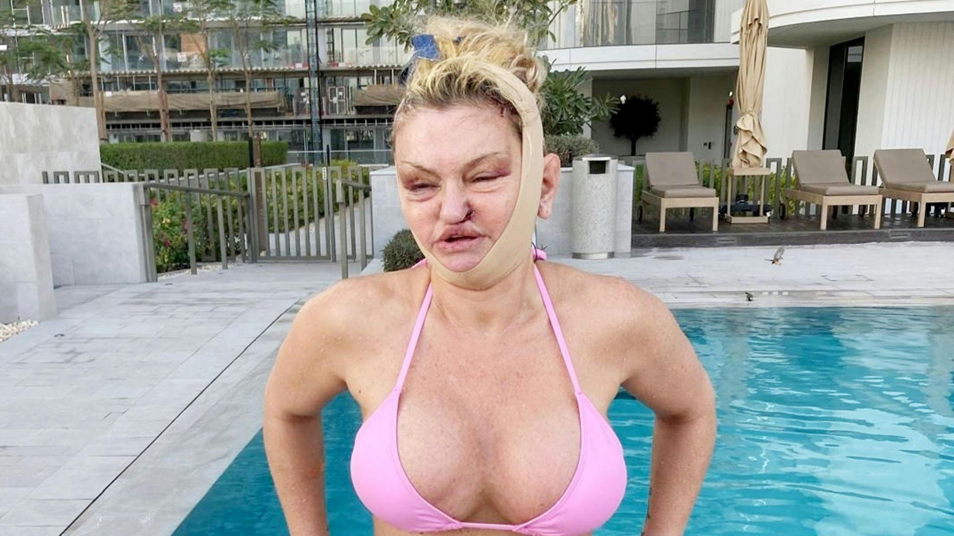 Danniella Westbrook Aims for OnlyFans Stardom Following Extensive