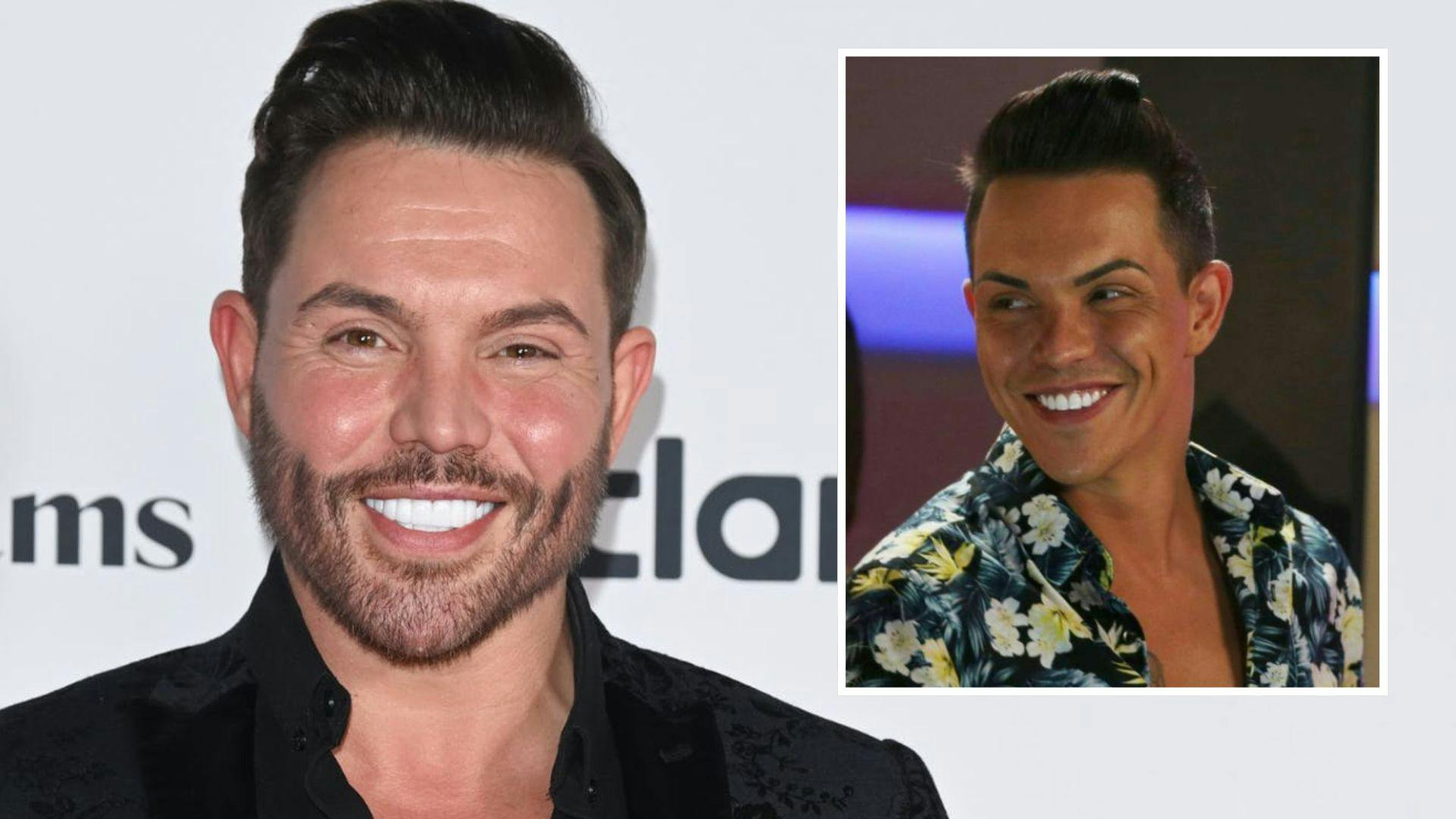 Fans react as Bobby Norris unveils face lift results