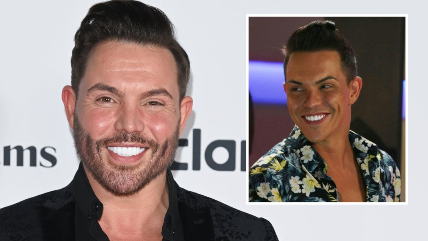 Fans react as Bobby Norris unveils face lift results