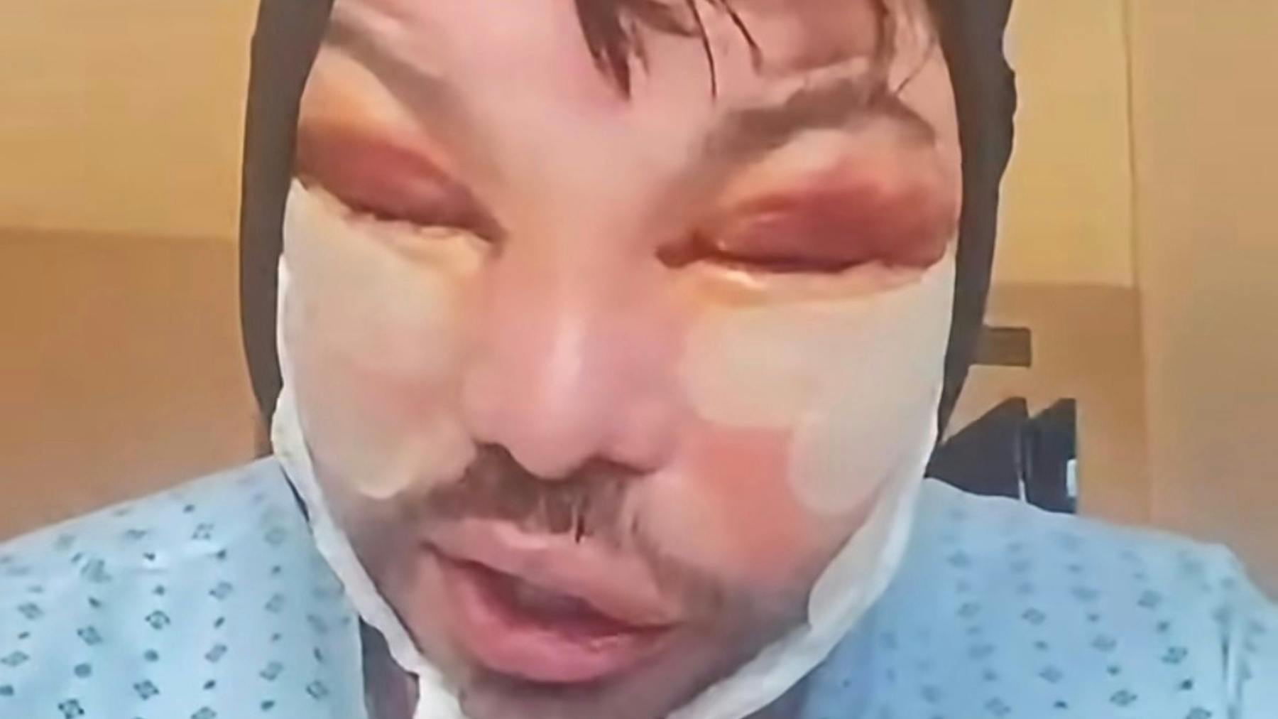 The shocking new trend for a ‘Forever 35’ face has left this young TV star disfigured and in agony