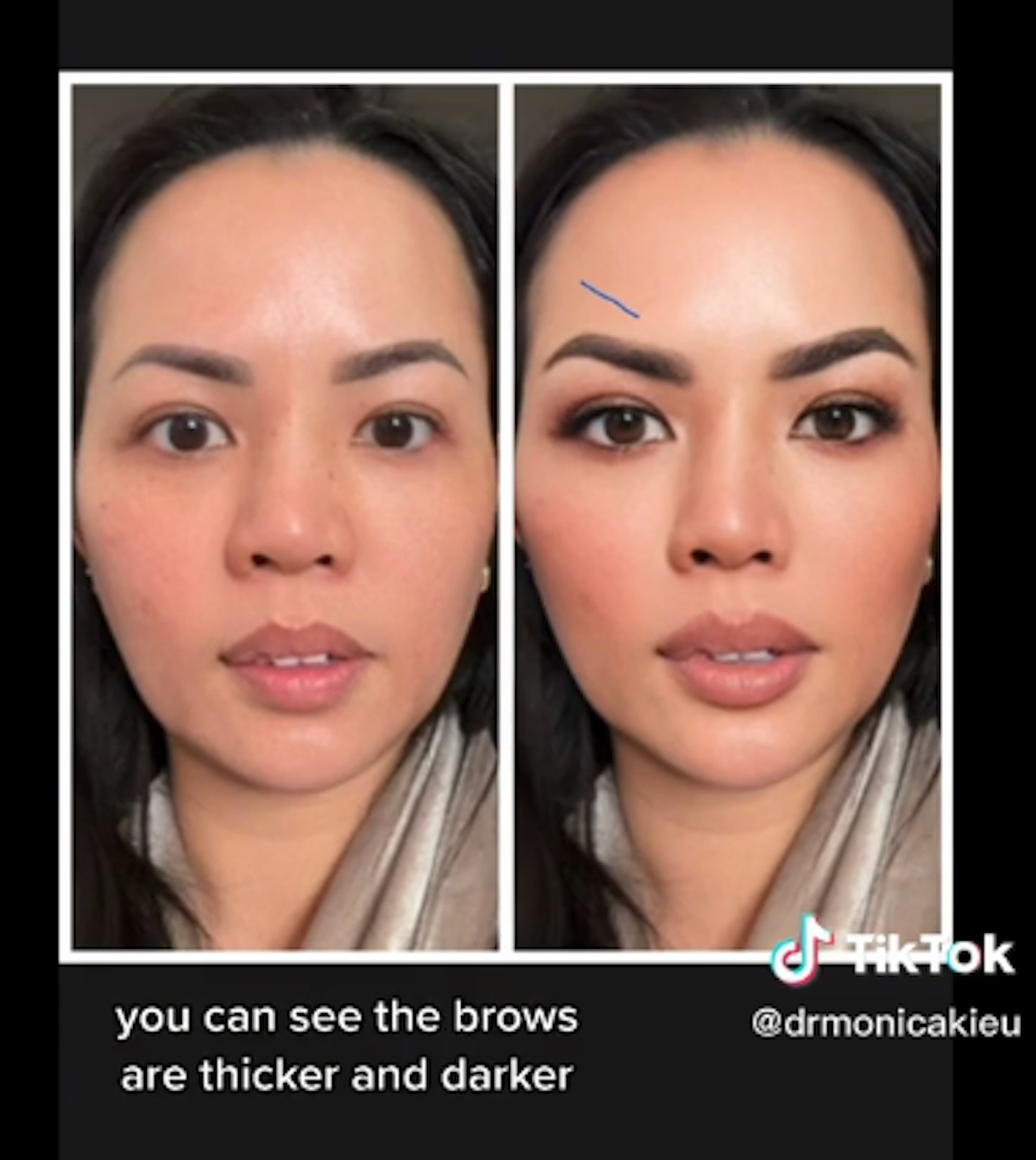 TikTok Bold Glamour filter: How to tell if someone is using it.