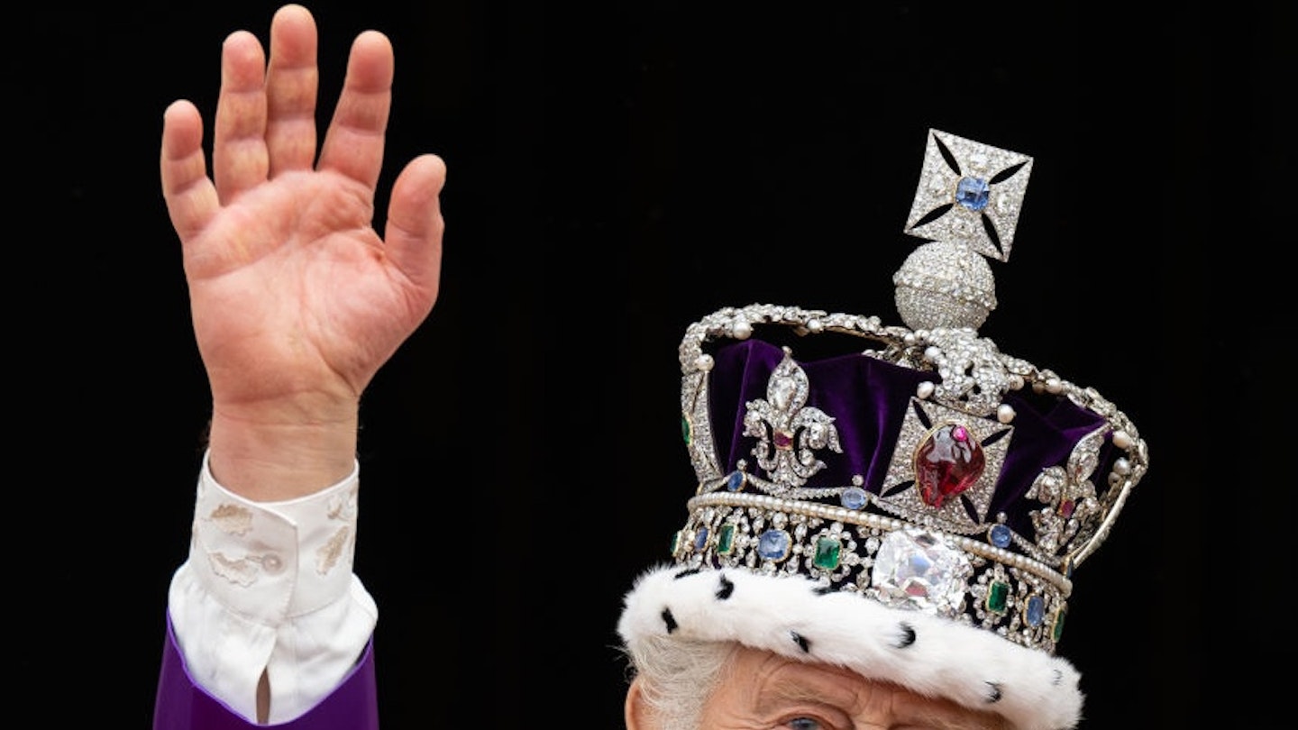 Here’s Why King Charles Fingers Are So Swollen