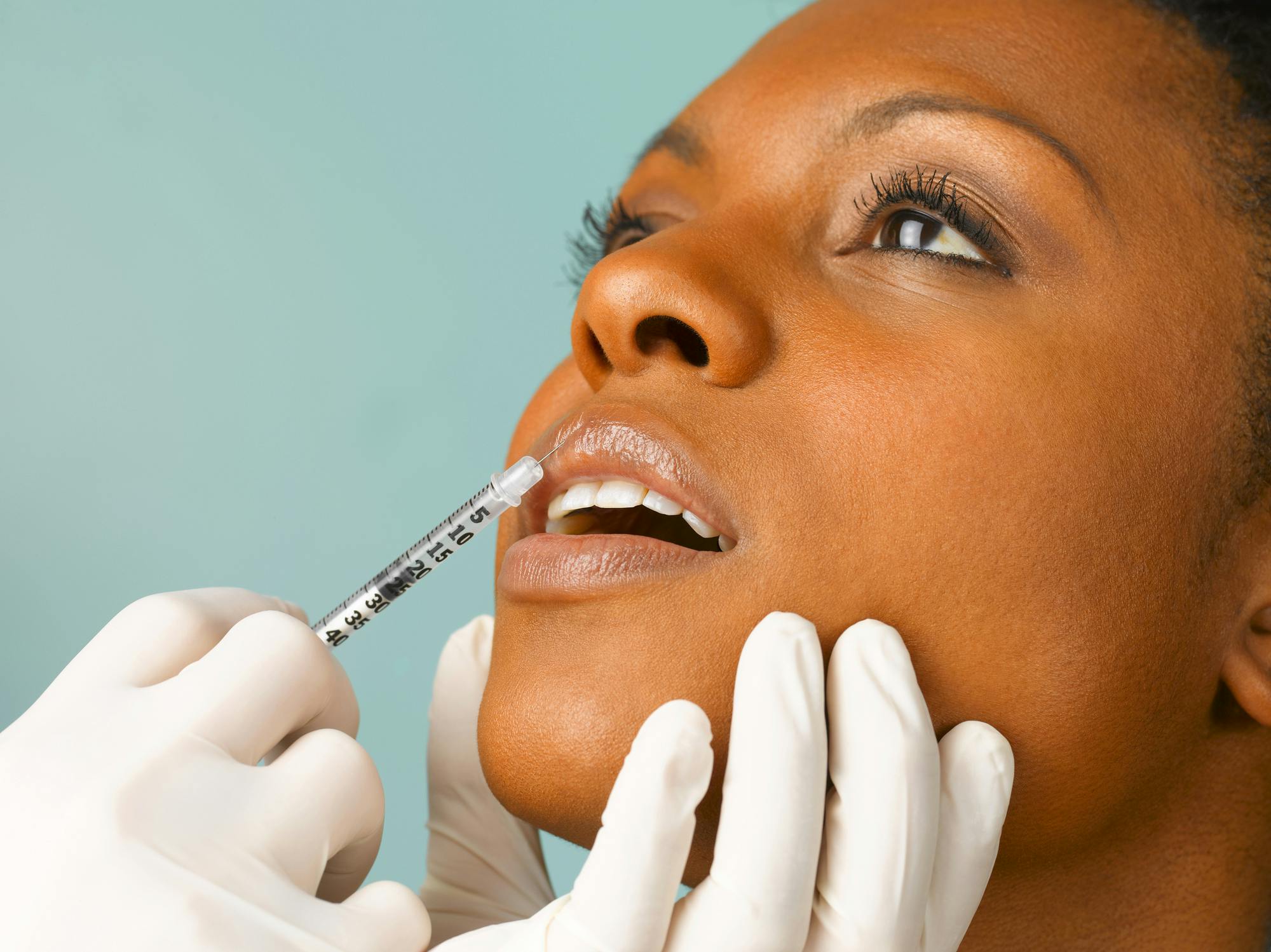 Dermal Filler What Is It And How Much Does It Cost?