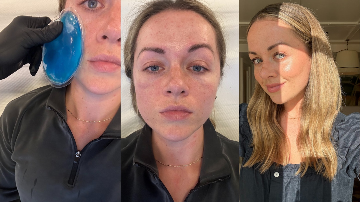 Before after cum facial