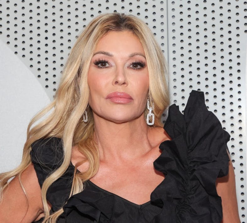 What Is Brandi Glanville's Face Condition? Her Parasite Explained