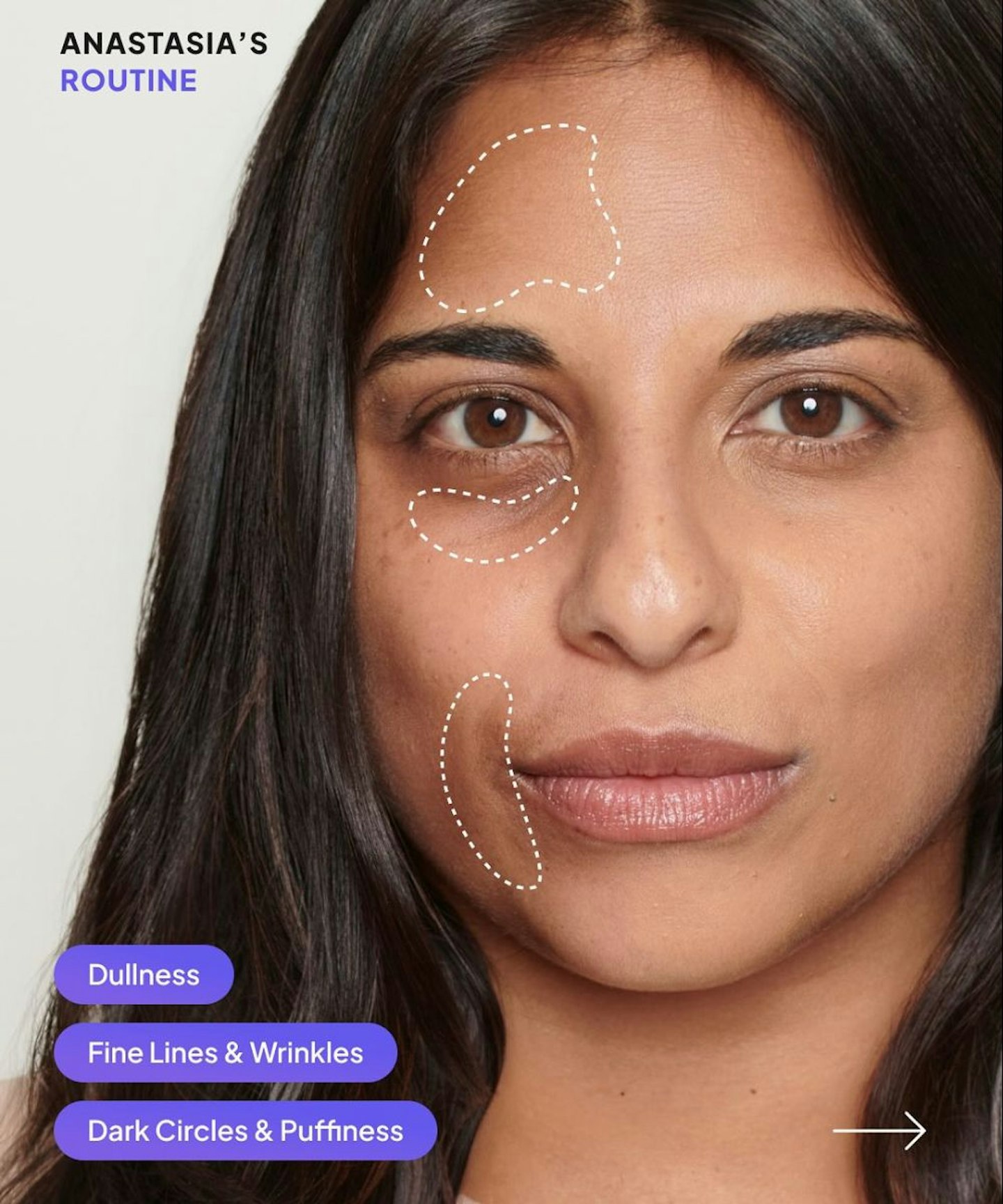 noli beauty skin analysis