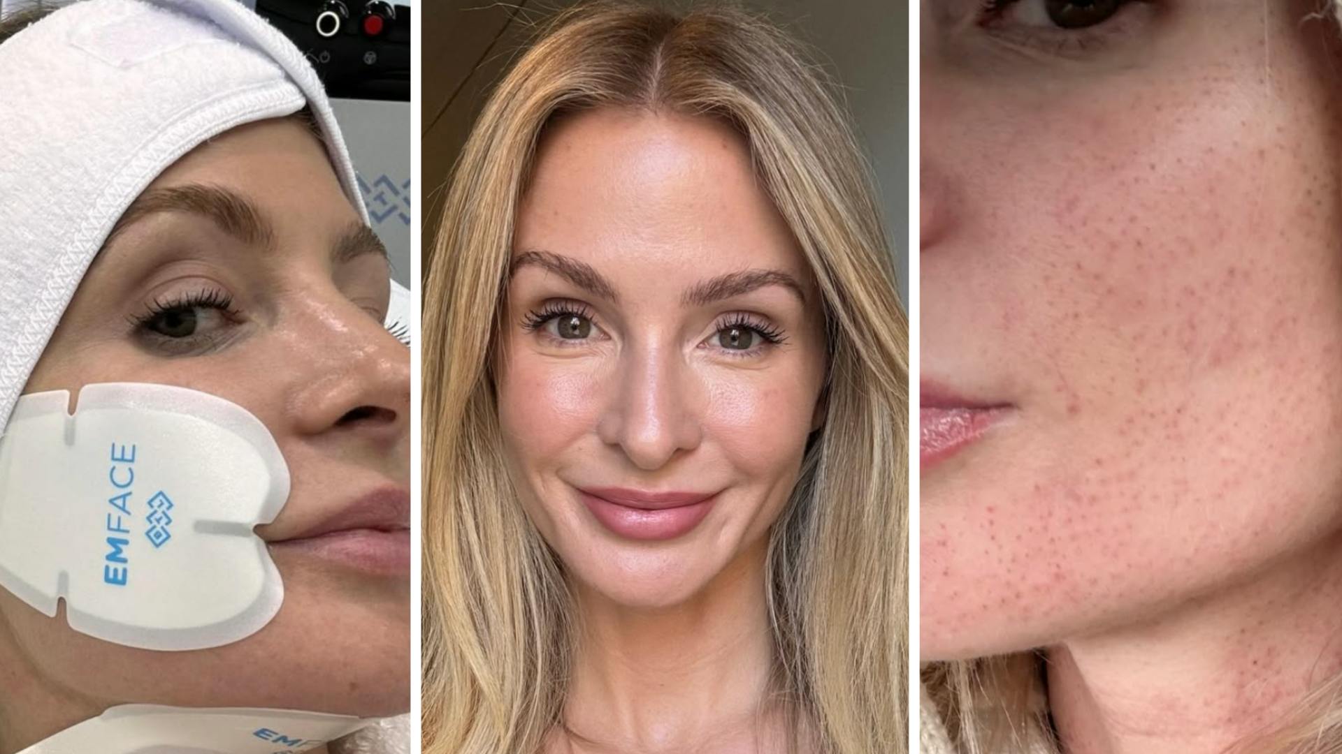 7 kosmetycznych zmian, które Millie Mackintosh przysięga, że ​​wygląda najlepiej – 6 to konieczność – Grazia Daily UK