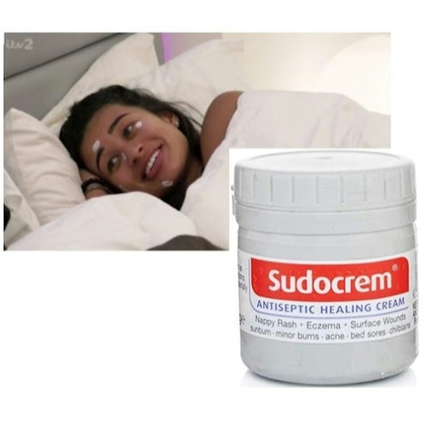 Sudocrem Is A Spot Solution To Consider