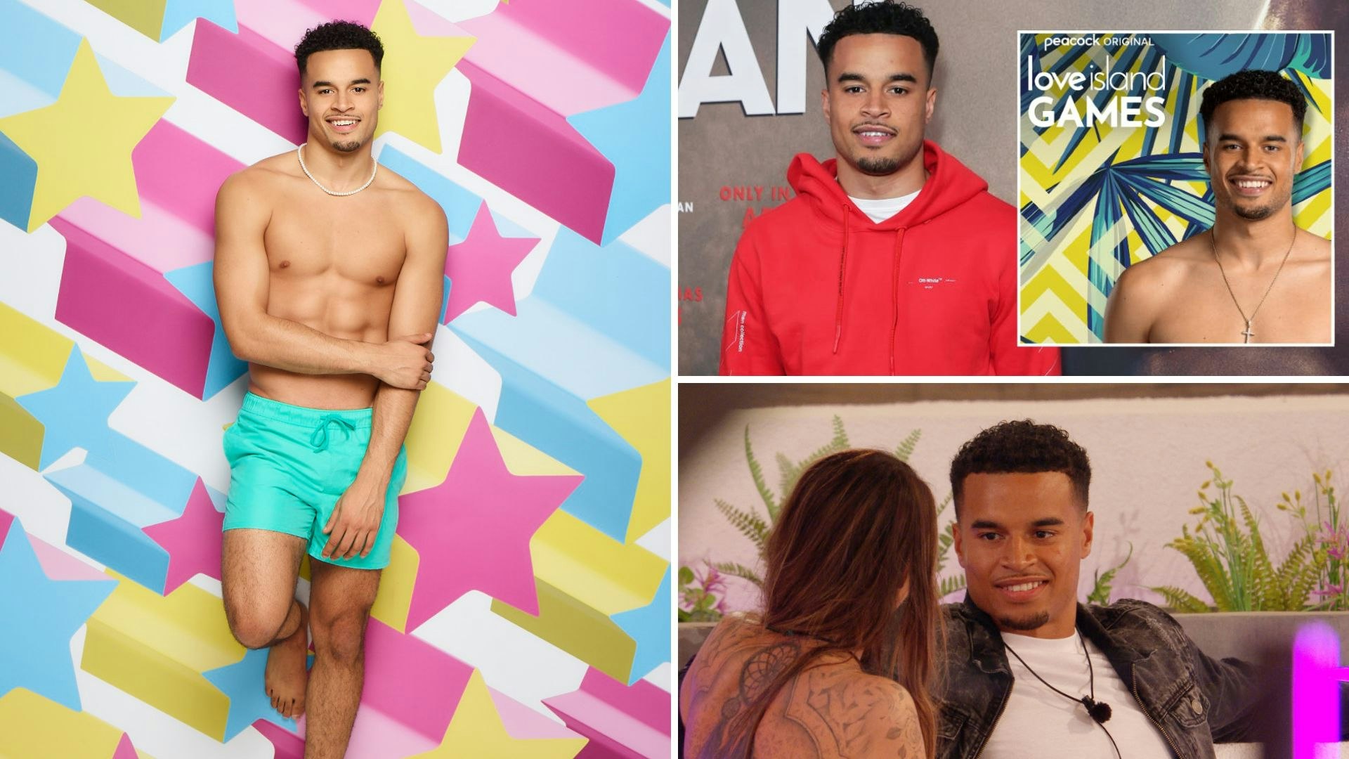 What Is Wrong With Toby Love Island Teeth 2024? Health Update