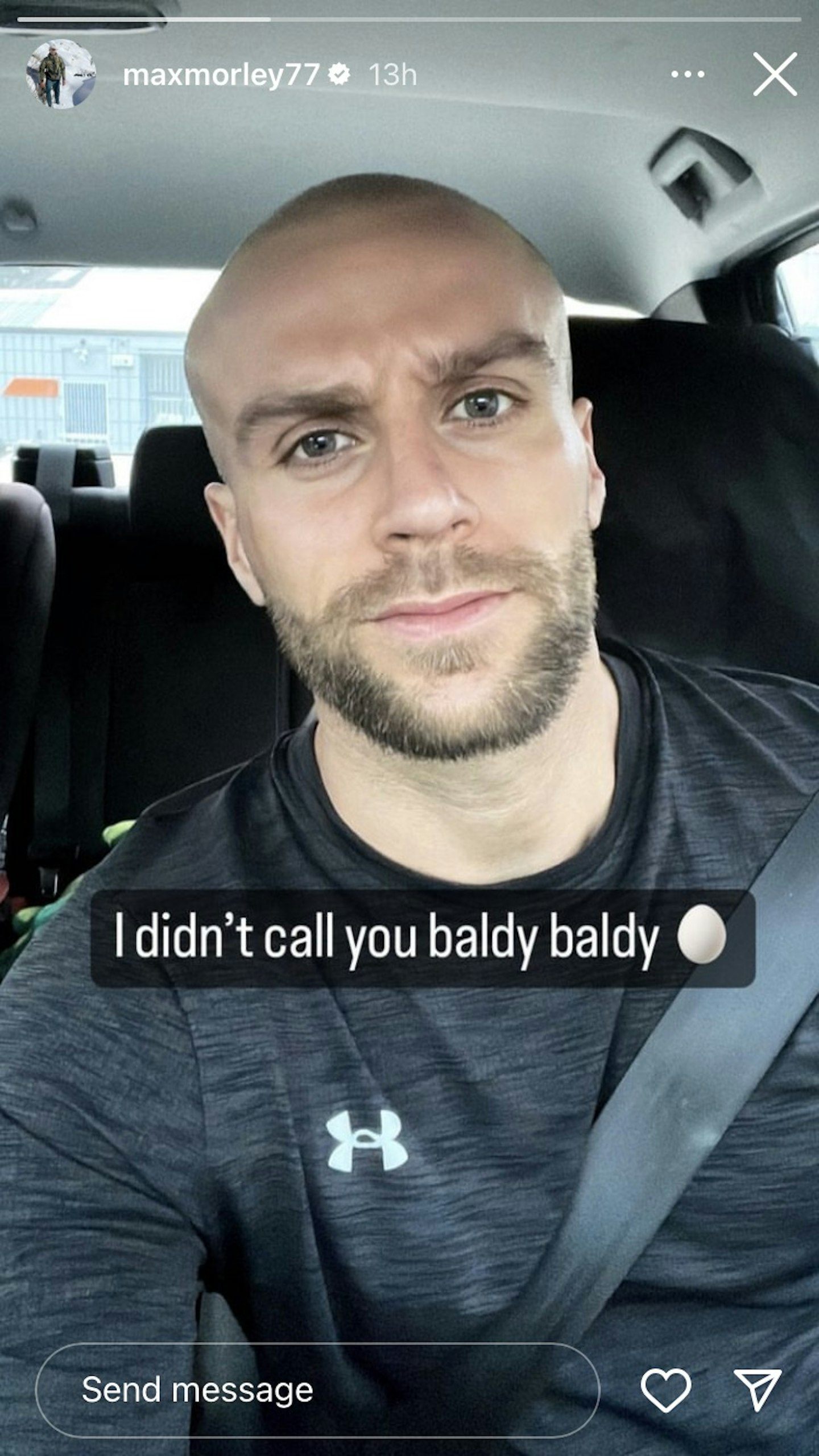 A selfie of Max Morley with no hair taken from his Instagram story
