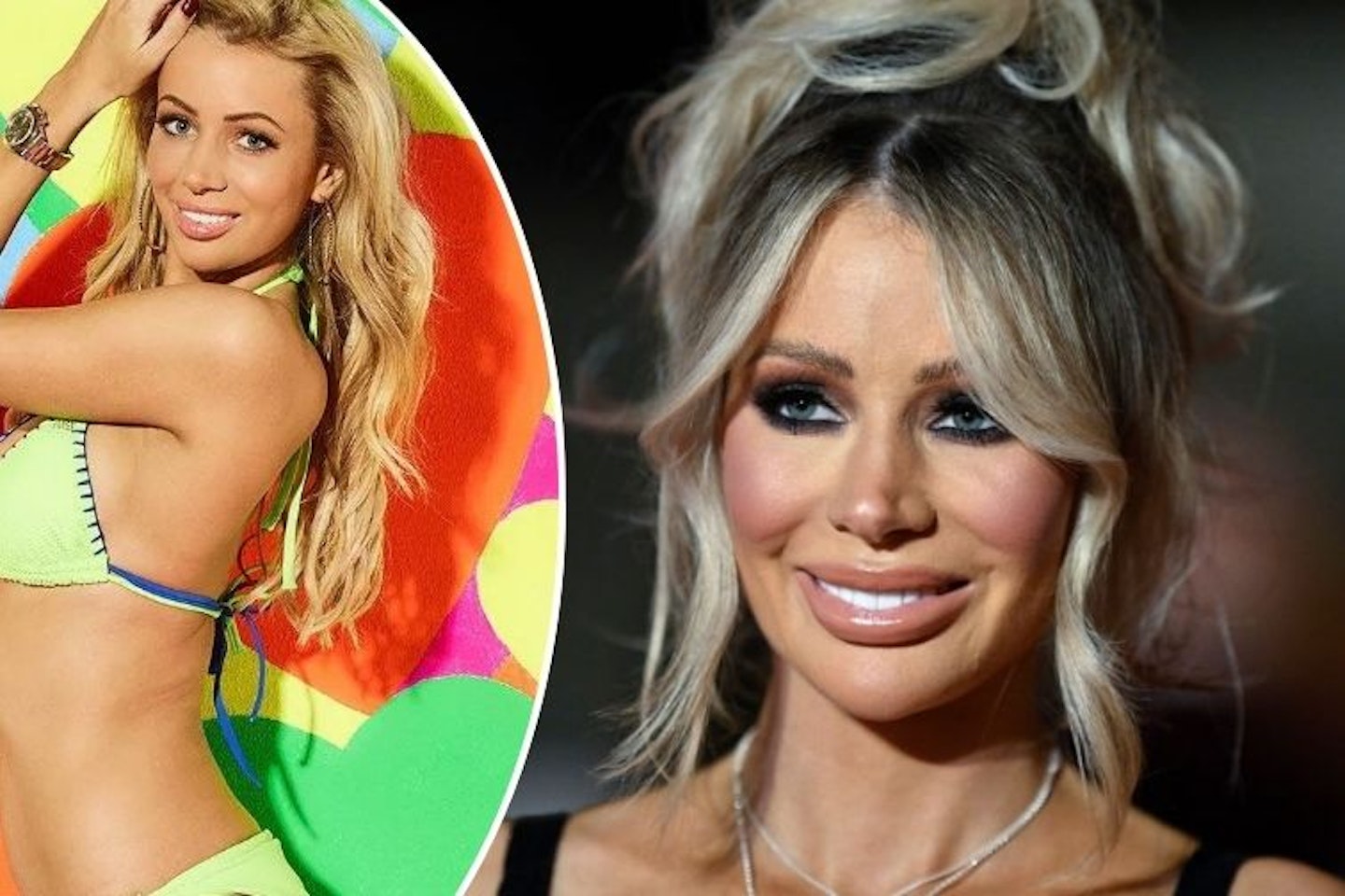 Olivia Attwood So Right It's Wrong podcast Love Island