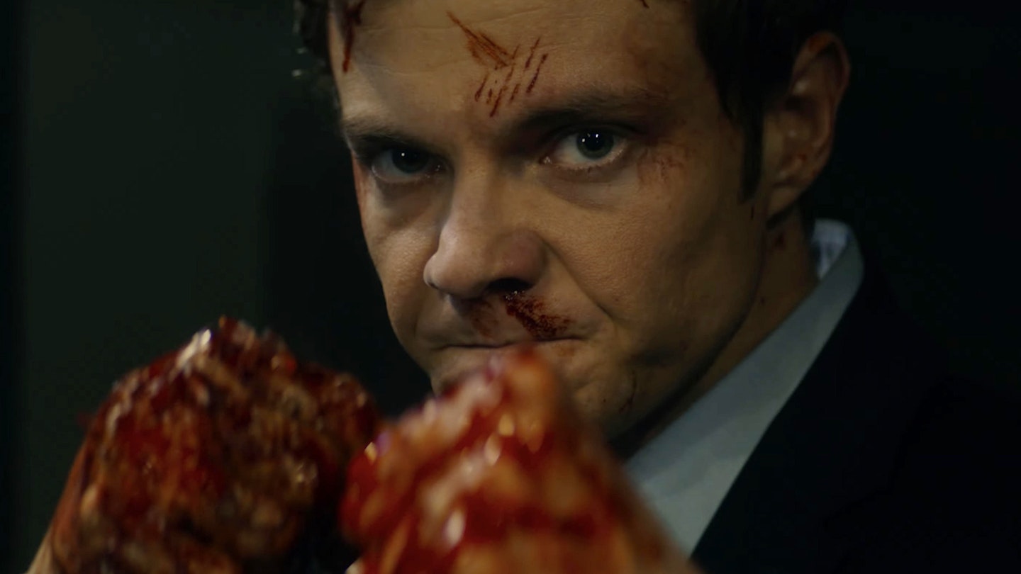 Novocaine Review – 'Okay, rather than great'