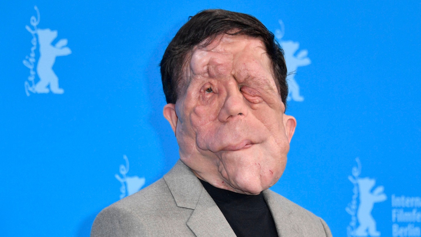 Adam Pearson Will Lead A New Movie Take On The Elephant Man