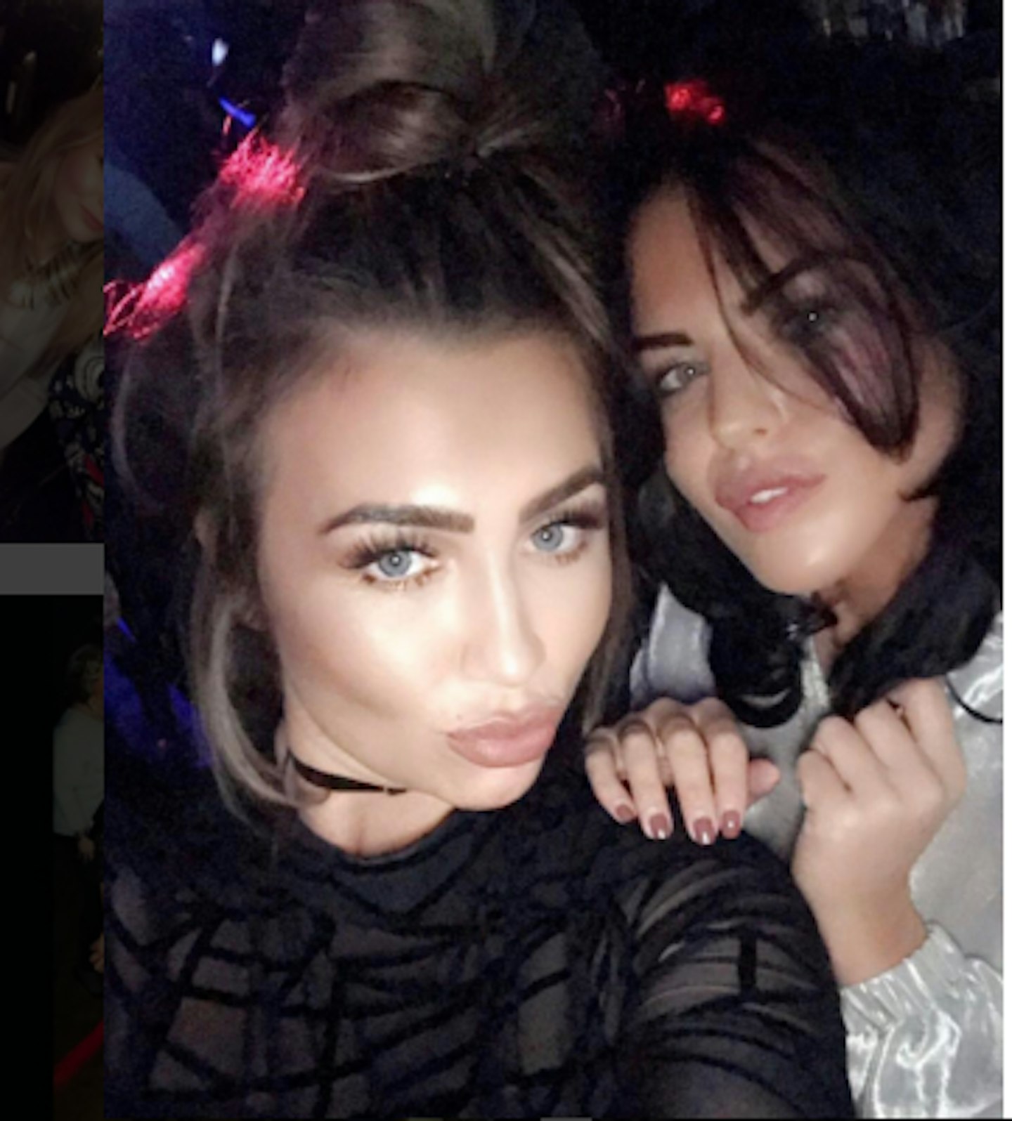 Has Lauren Goodger had plastic surgery? 