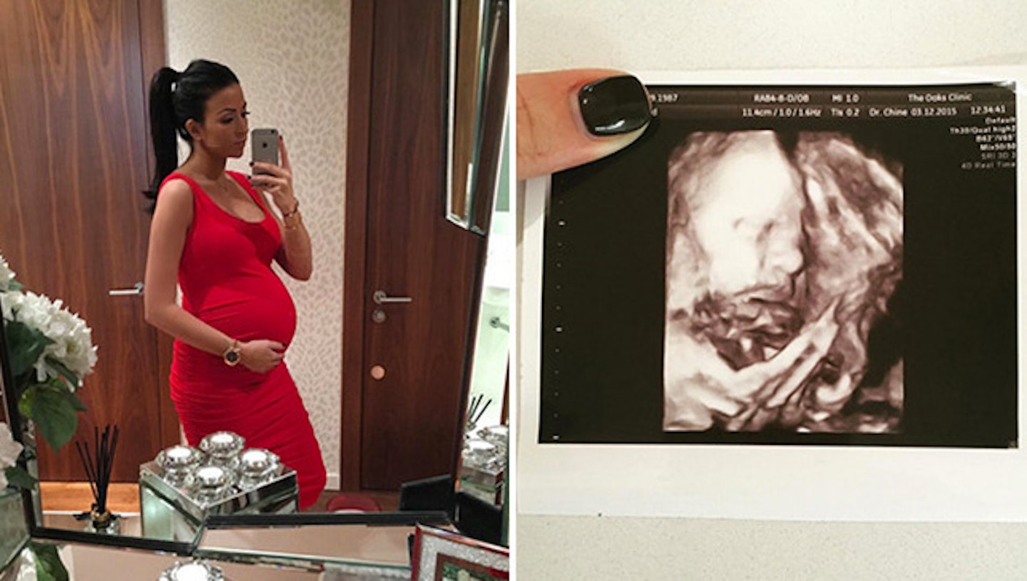 cara kilbey pregnant baby scan
