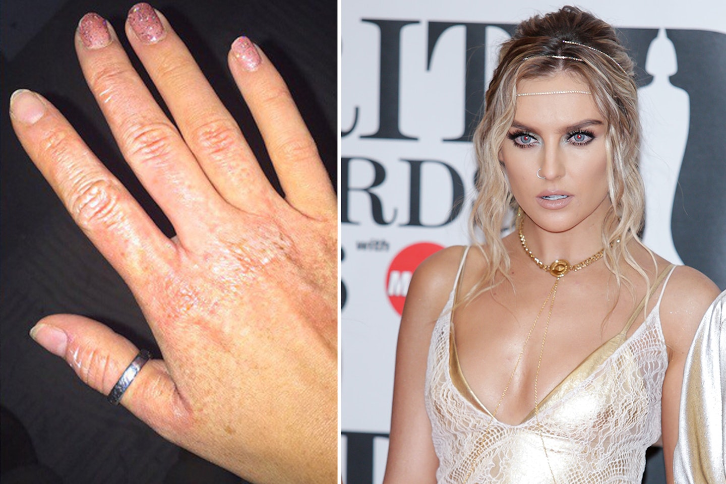 perrie edwards burns