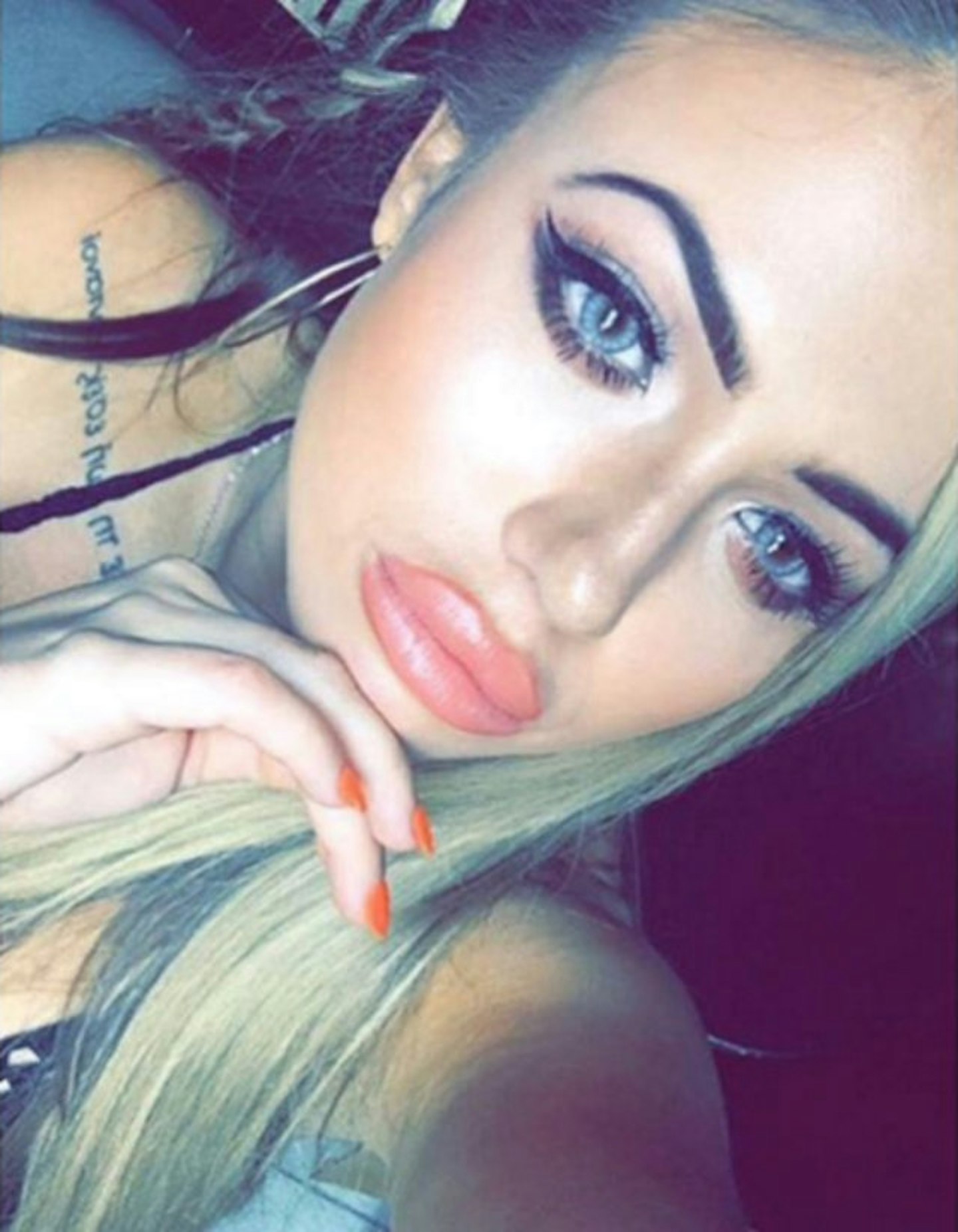 holly hagan plastic surgery lips