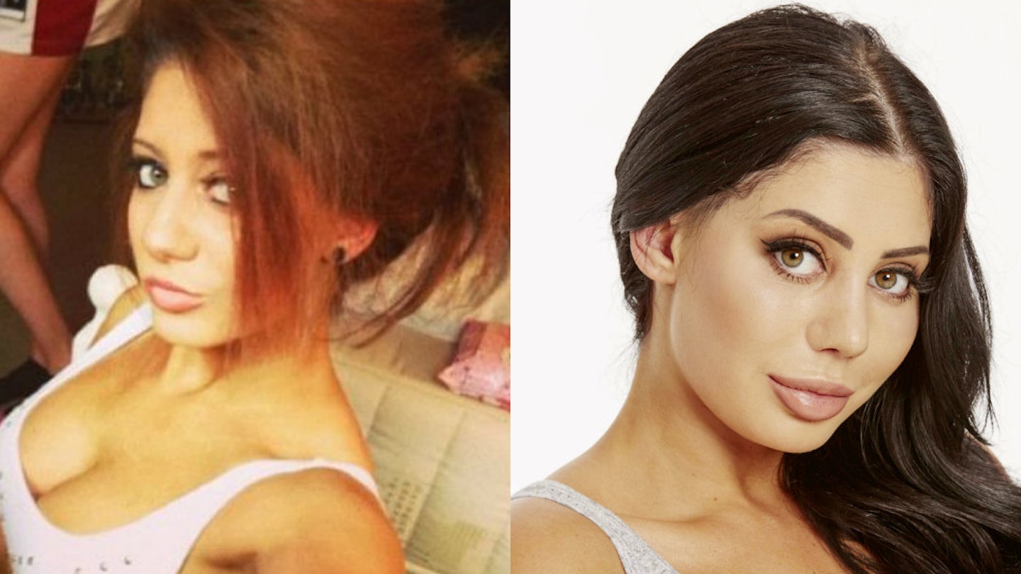 chloe ferry geordie shore nose job before and after