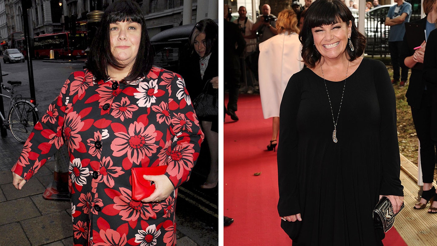 Dawn French Weight Loss : The Surprising Secrets Revealed