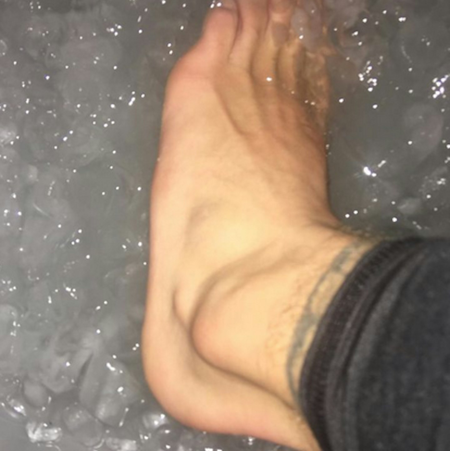 bieberankle