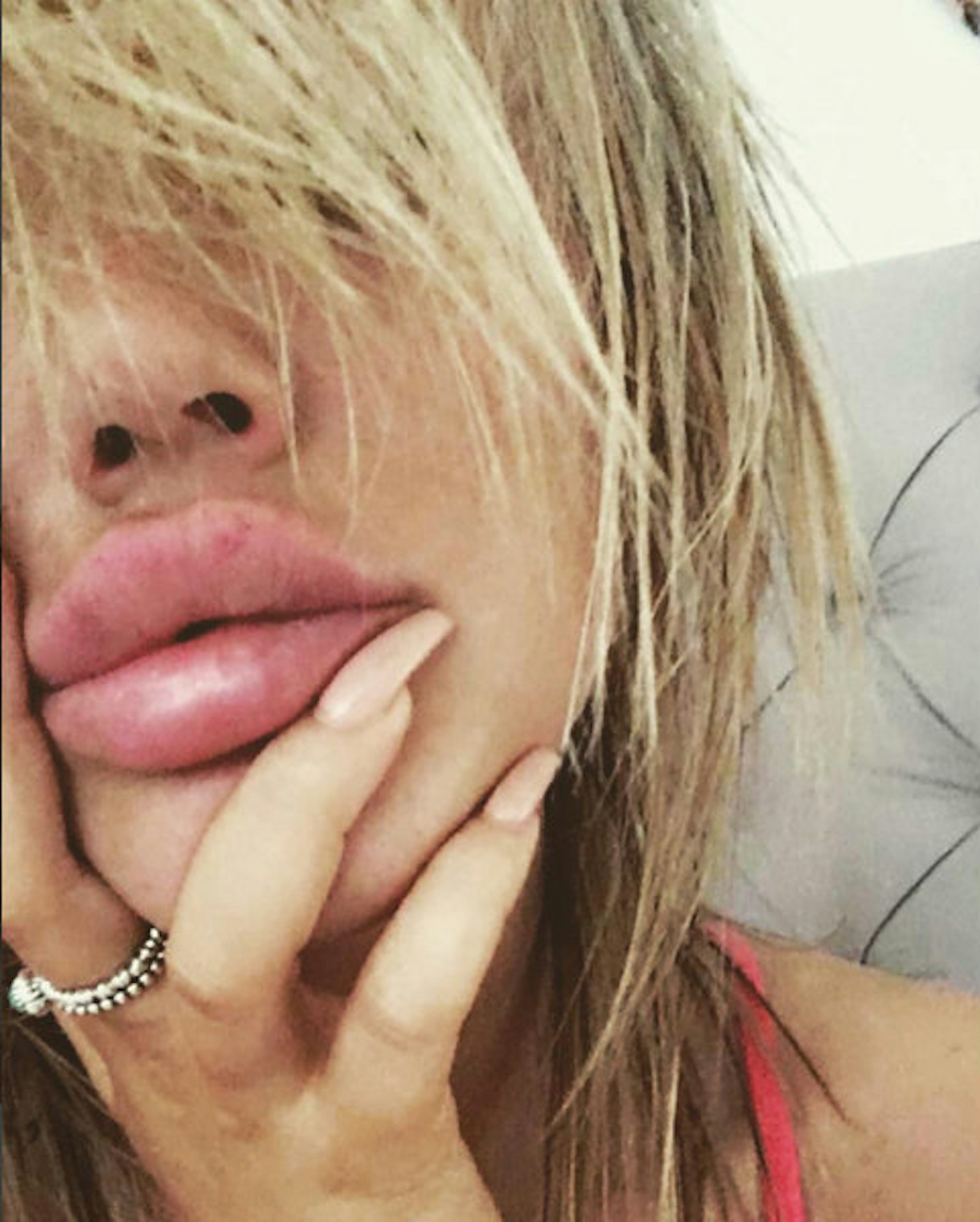 charlotte crosby lip fillers