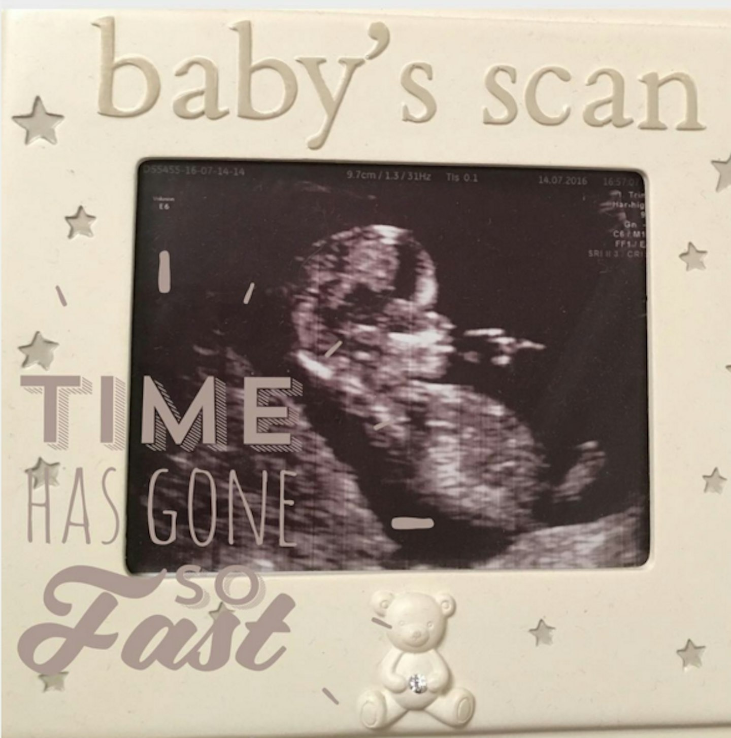 Stephanie Davis baby scan