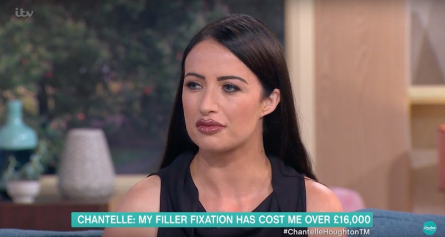 Chantelle Houghton blames boob job on Celebrity Big Brother fame