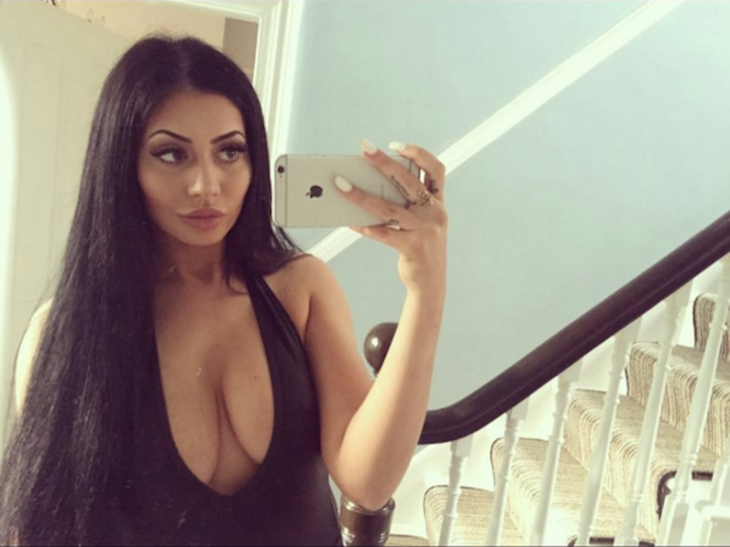 Geordie Shore Chloe Ferry plastic surgery before and after 