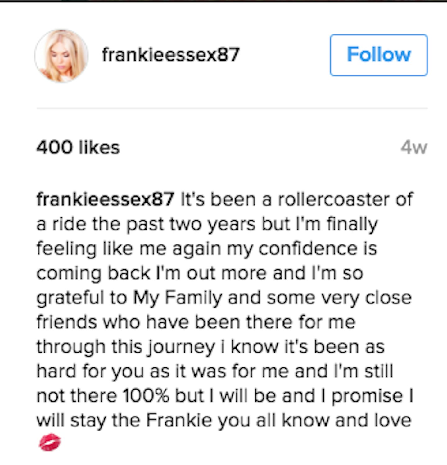 Frankie Essex