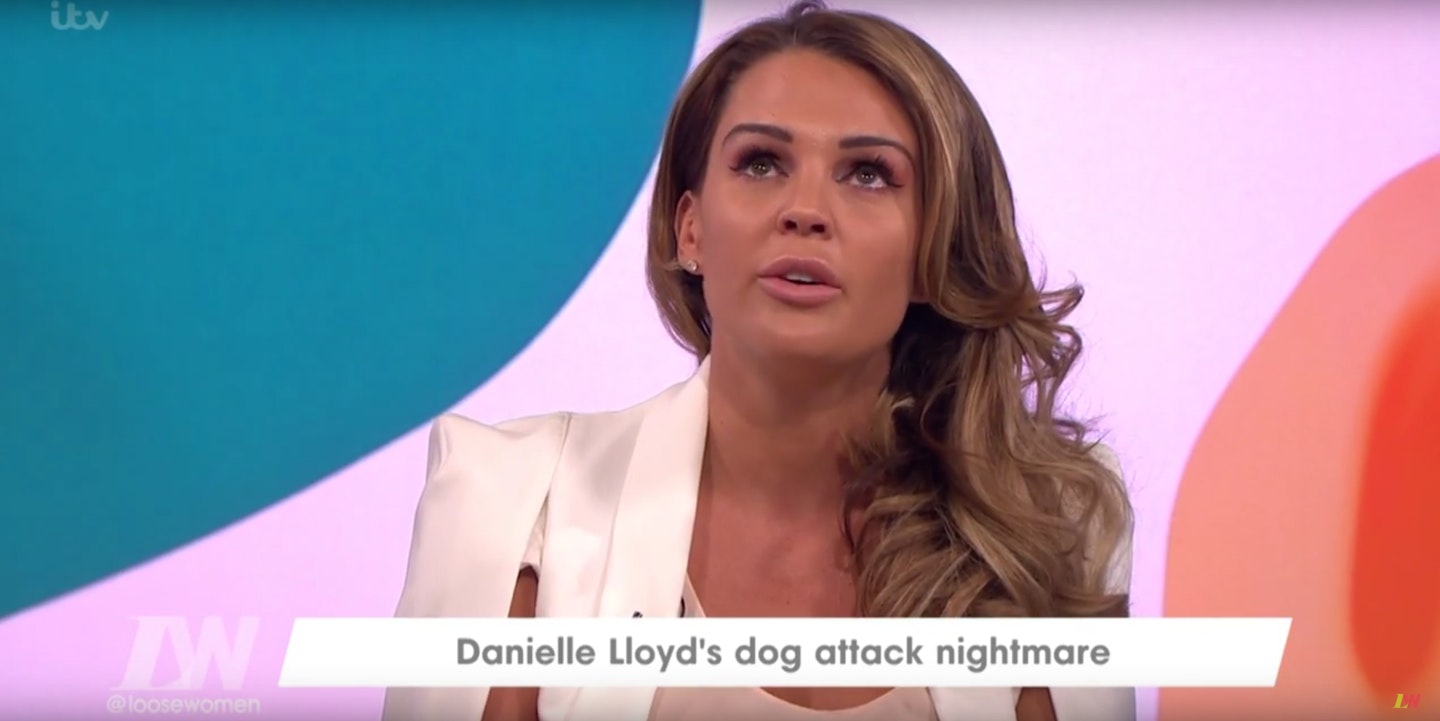 Danielle Lloyd dog attack 