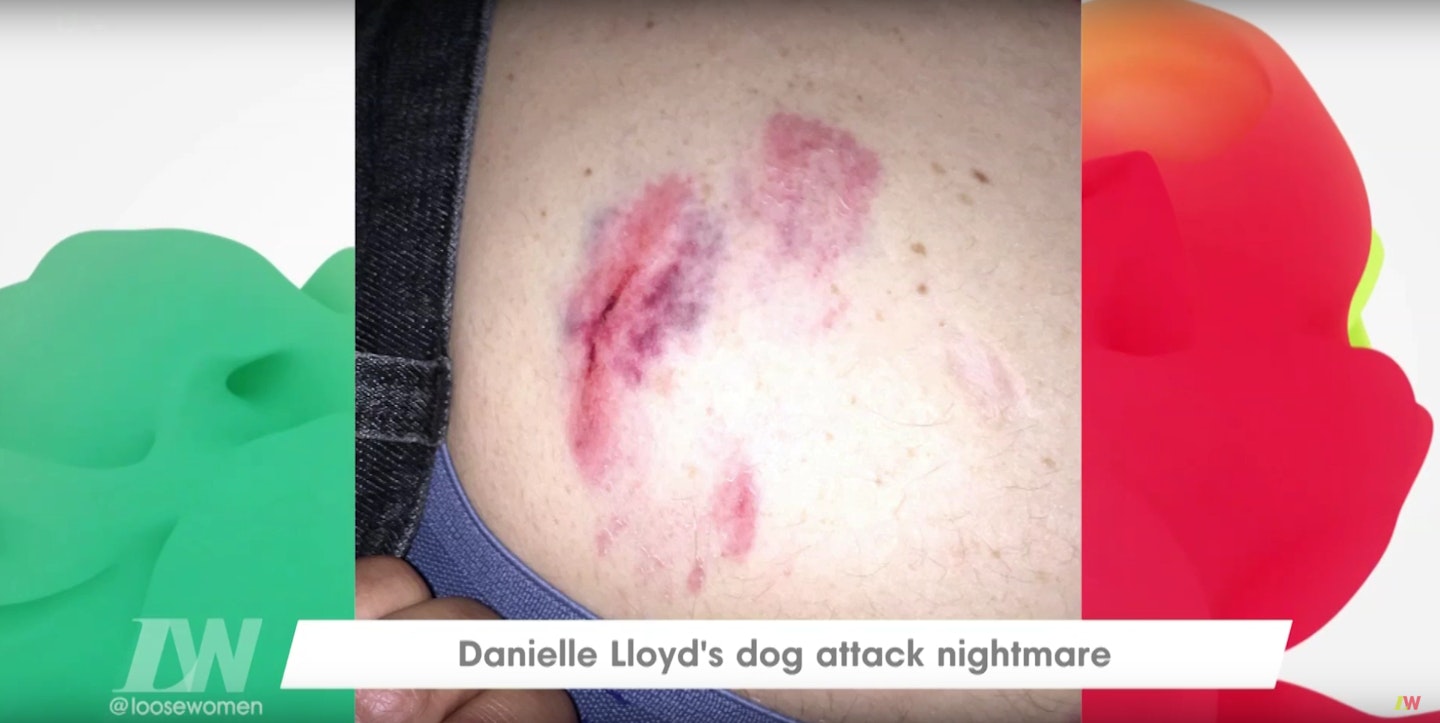 Danielle Lloyd dog attack 