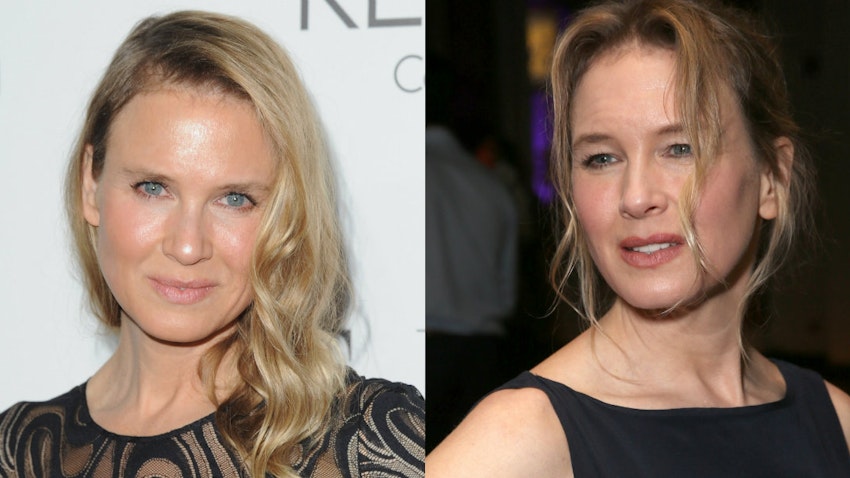 Renee Zellweger Opens Up About Those Plastic Surgery Rumours Closer Renee Zellweger Opens Up About Those Plastic Surgery Rumours Closer