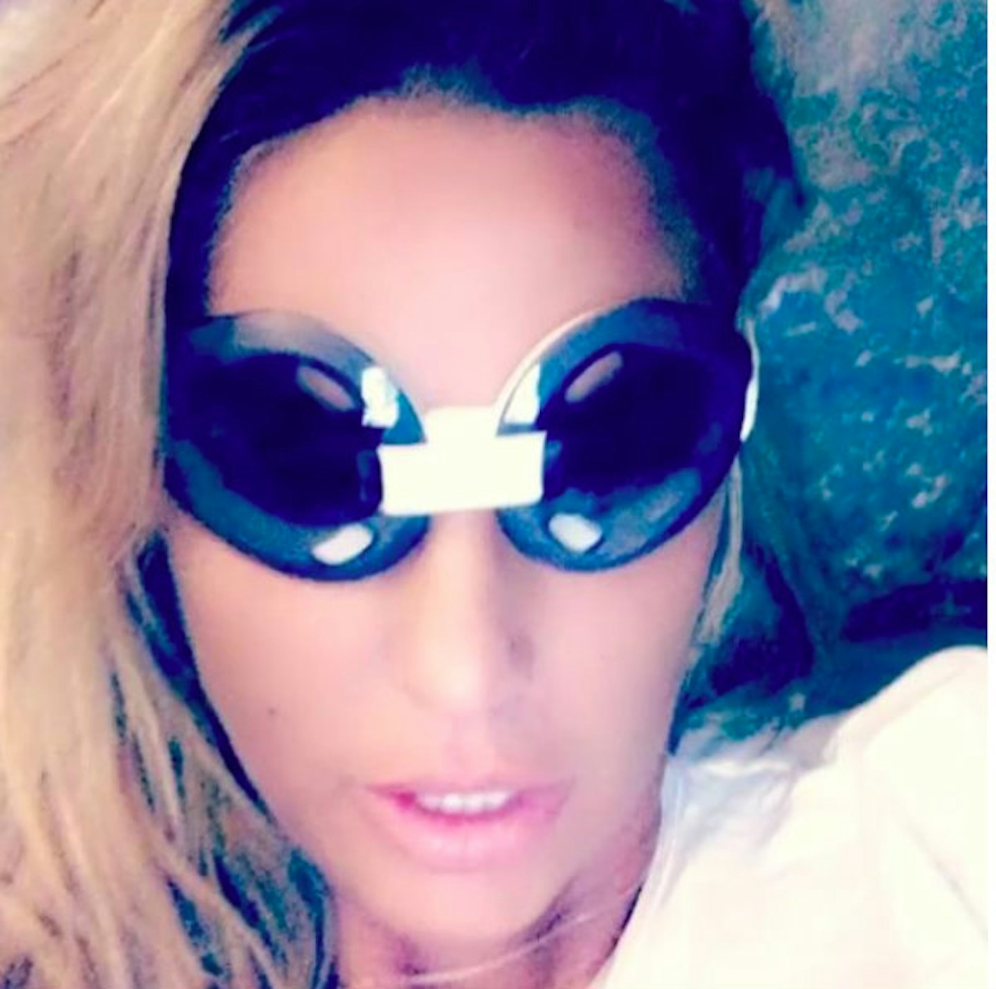 Katie Price goggles post surgery