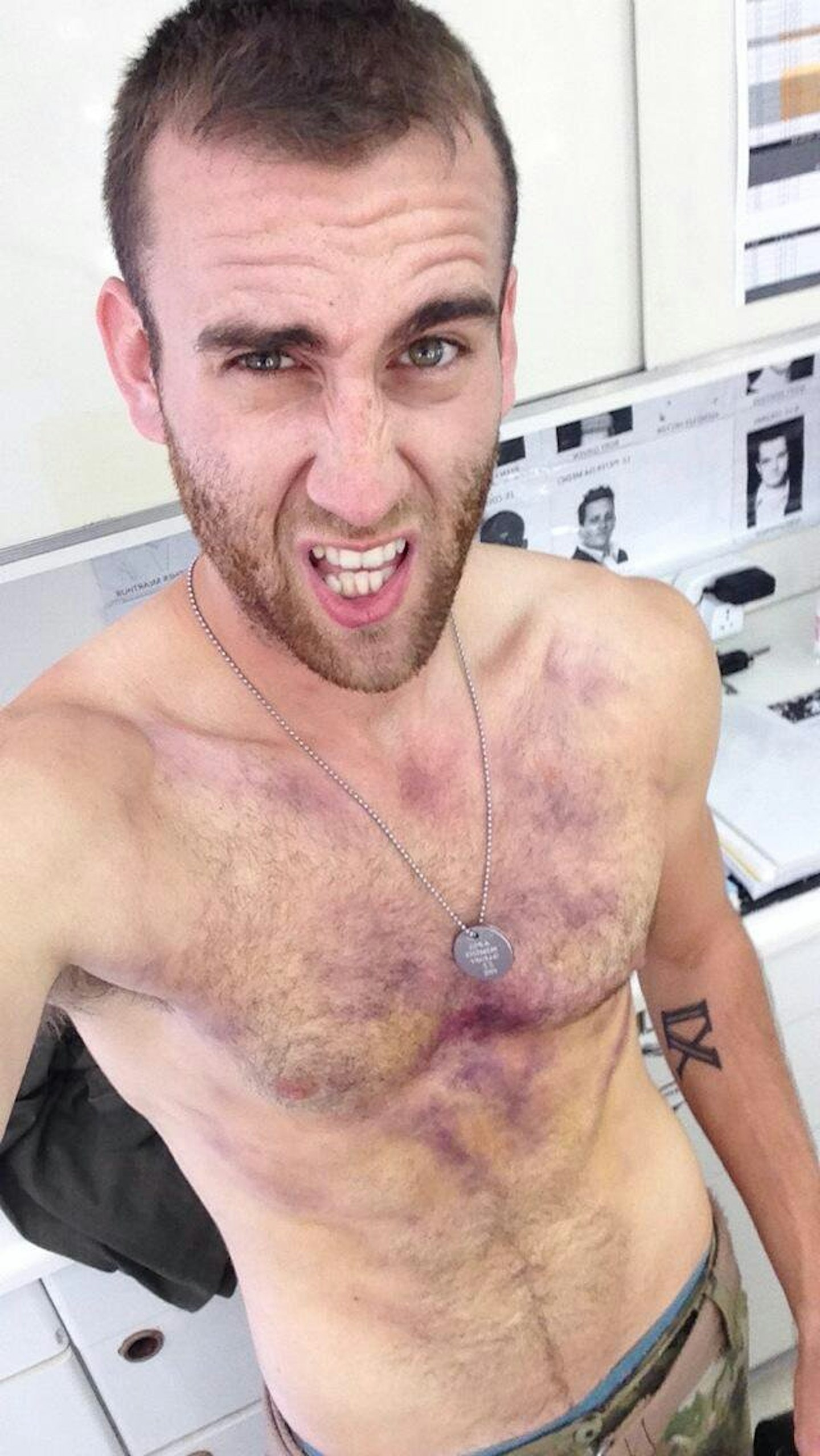 matthew lewis - neville longbottom - hottest pics