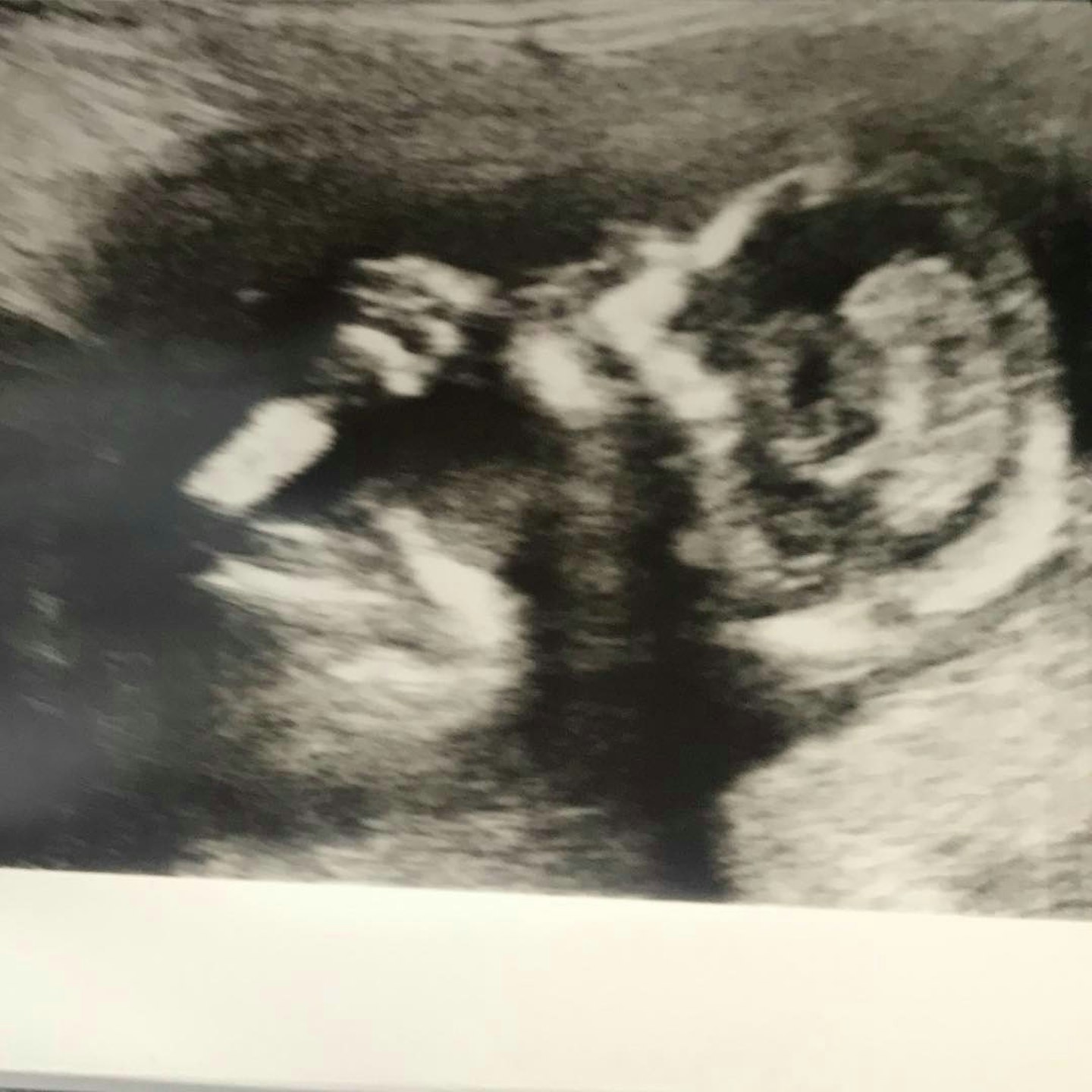 danielle-lloyd-pregnant-baby-scan