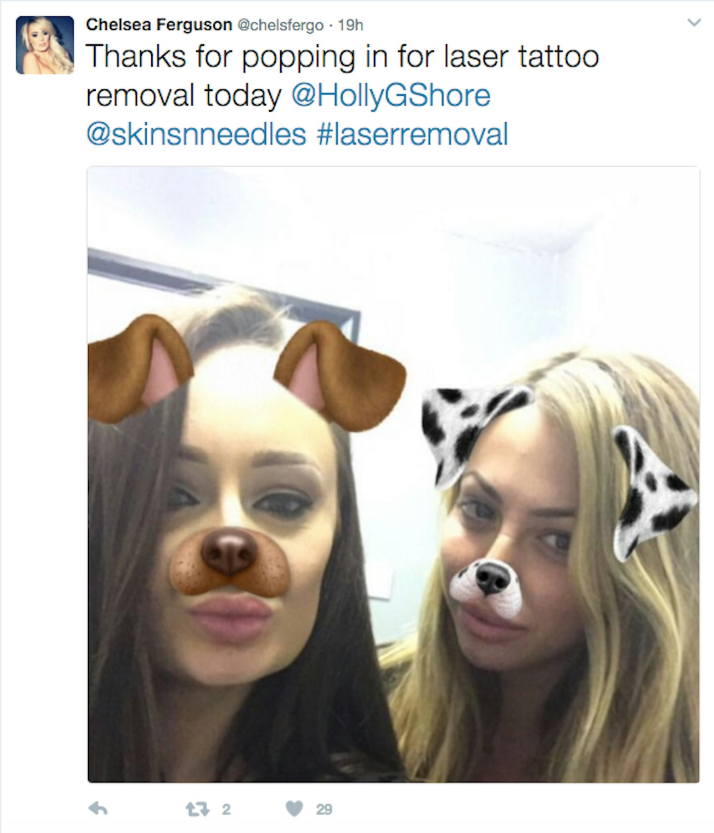 Holly Hagan tattoo removal