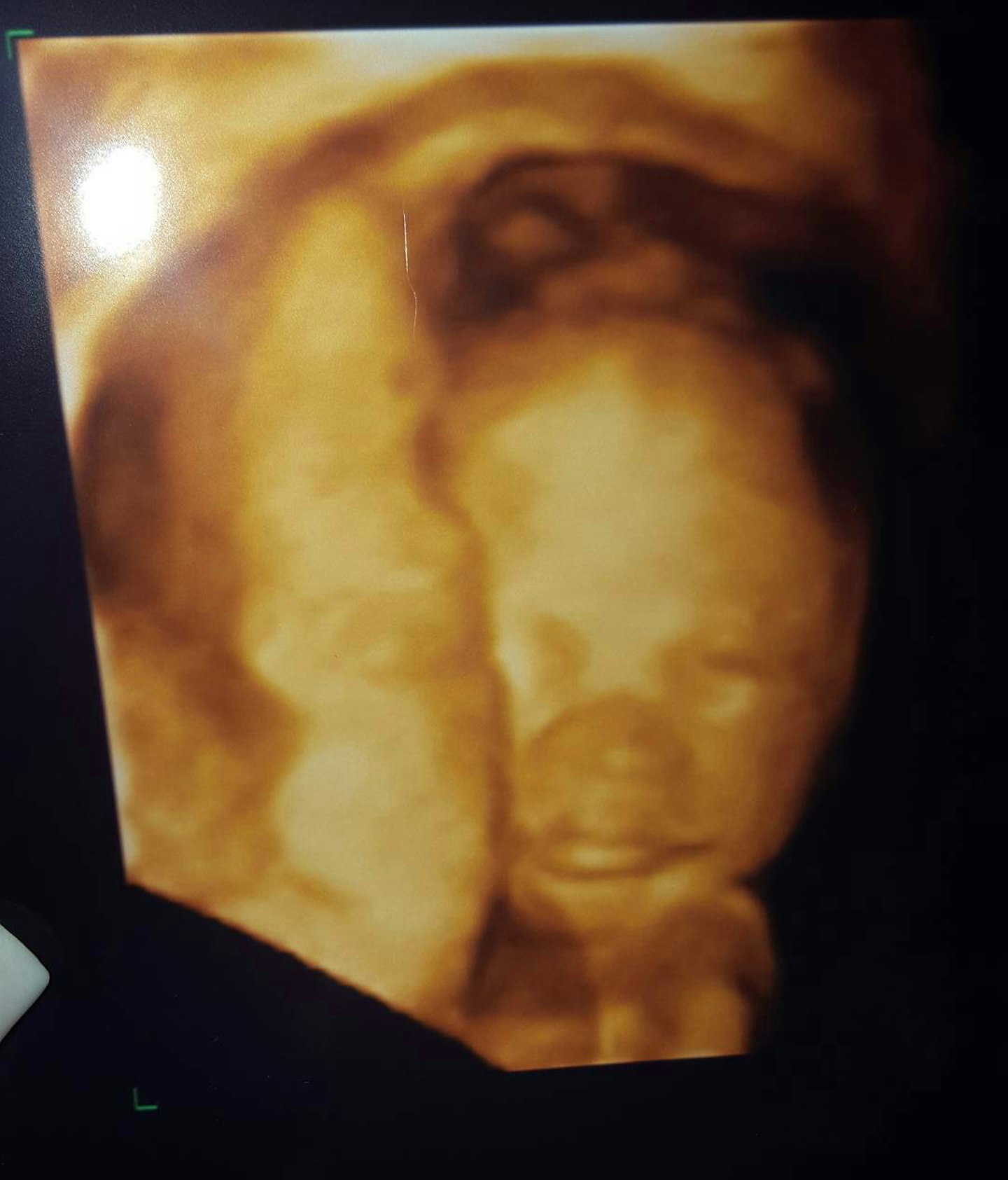 pregnant-chelsee-healey-shares-3d-scan-baby-hollyoaks-jack-molloy-boyfriend