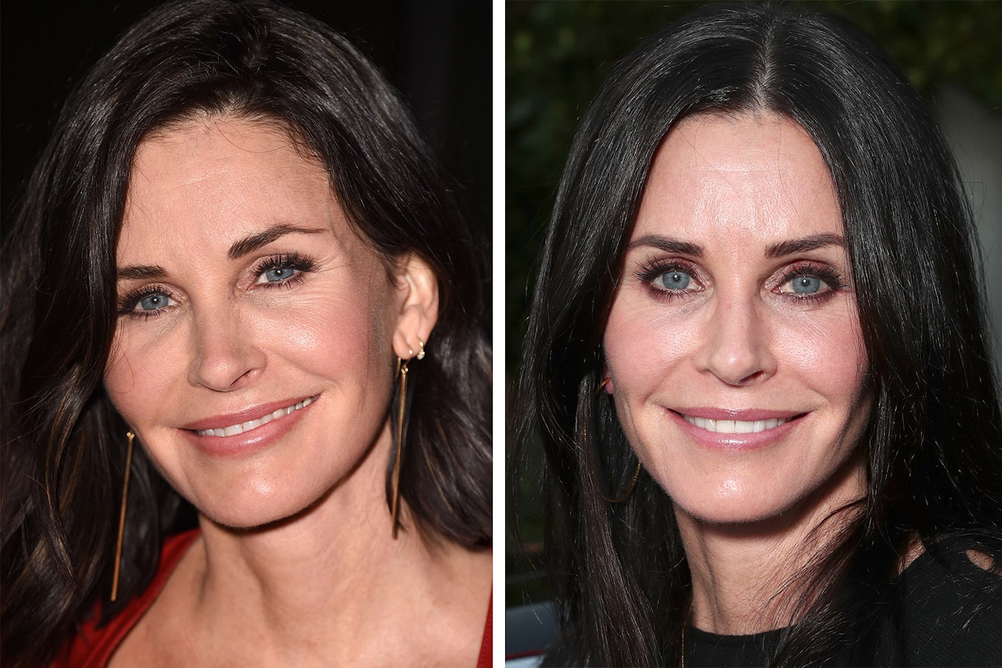 courteney-cox-fillers-dissolved-plastic-surgery
