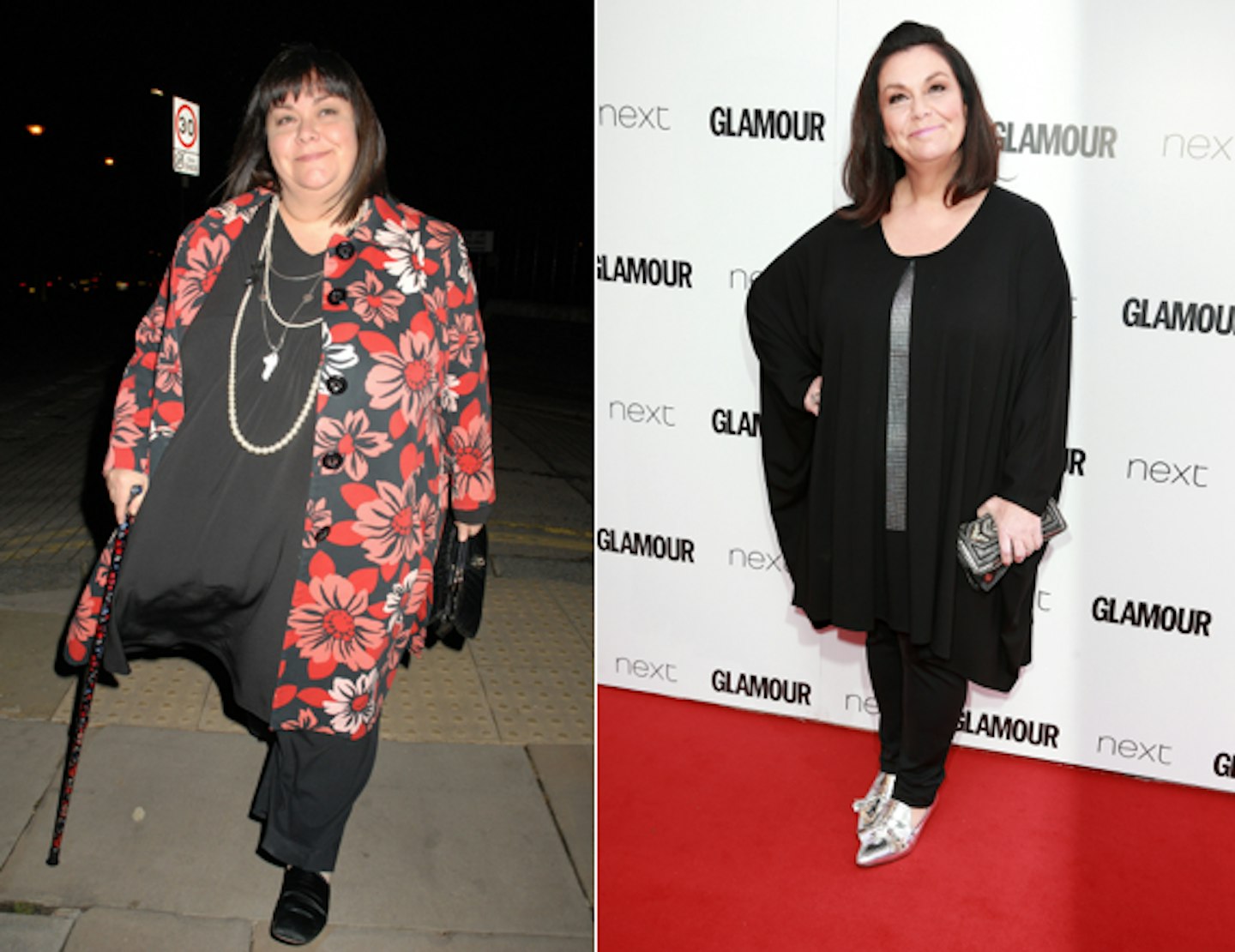 dawn,french,weight,loss