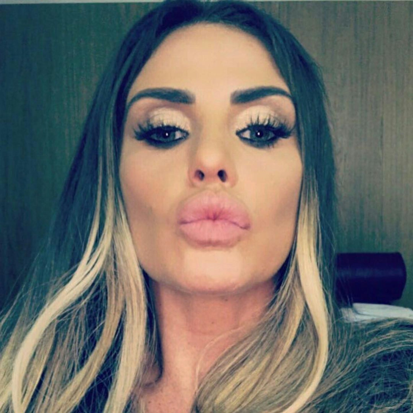 katie-price-accuse-drugs-facelift-cosmetic-surgery