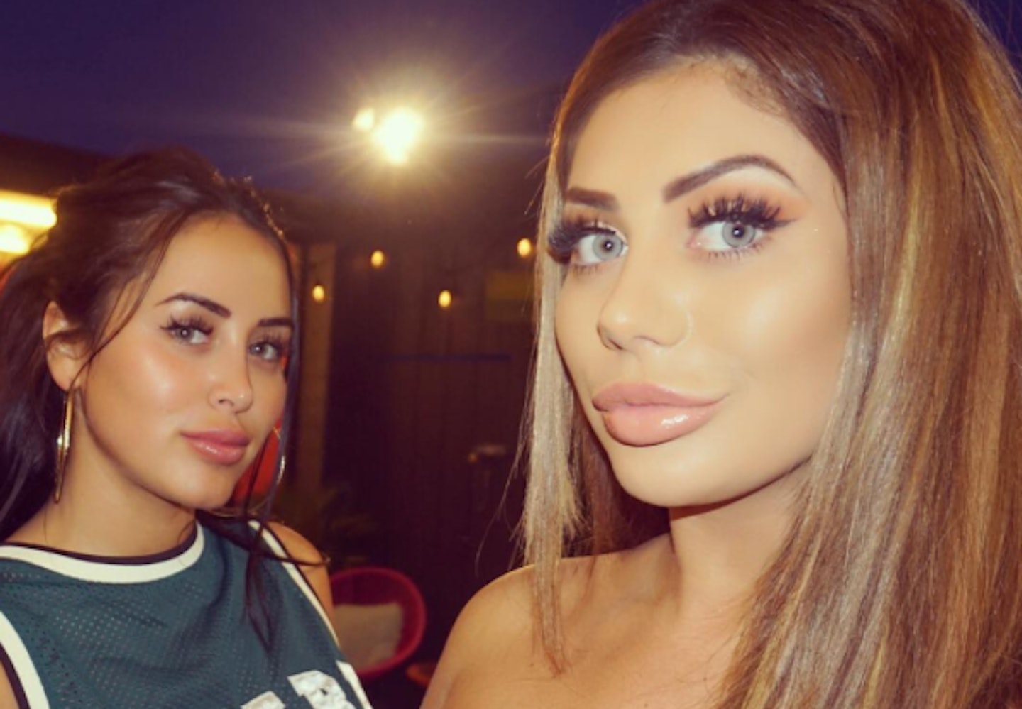 Chloe Ferry nose job 