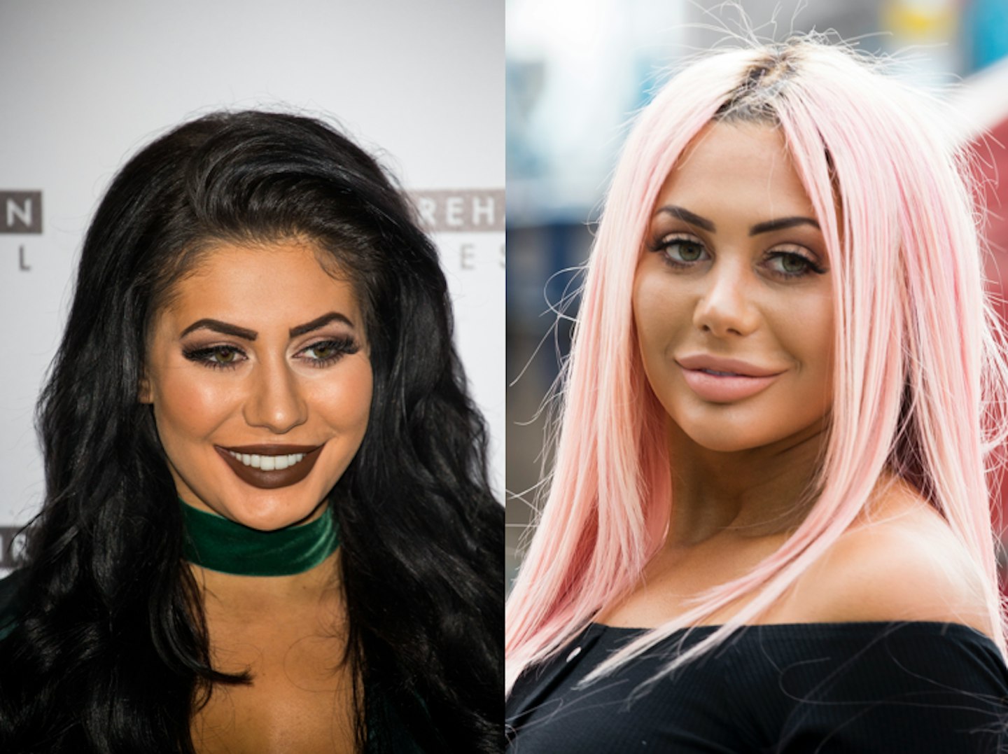 Chloe Ferry nose job 