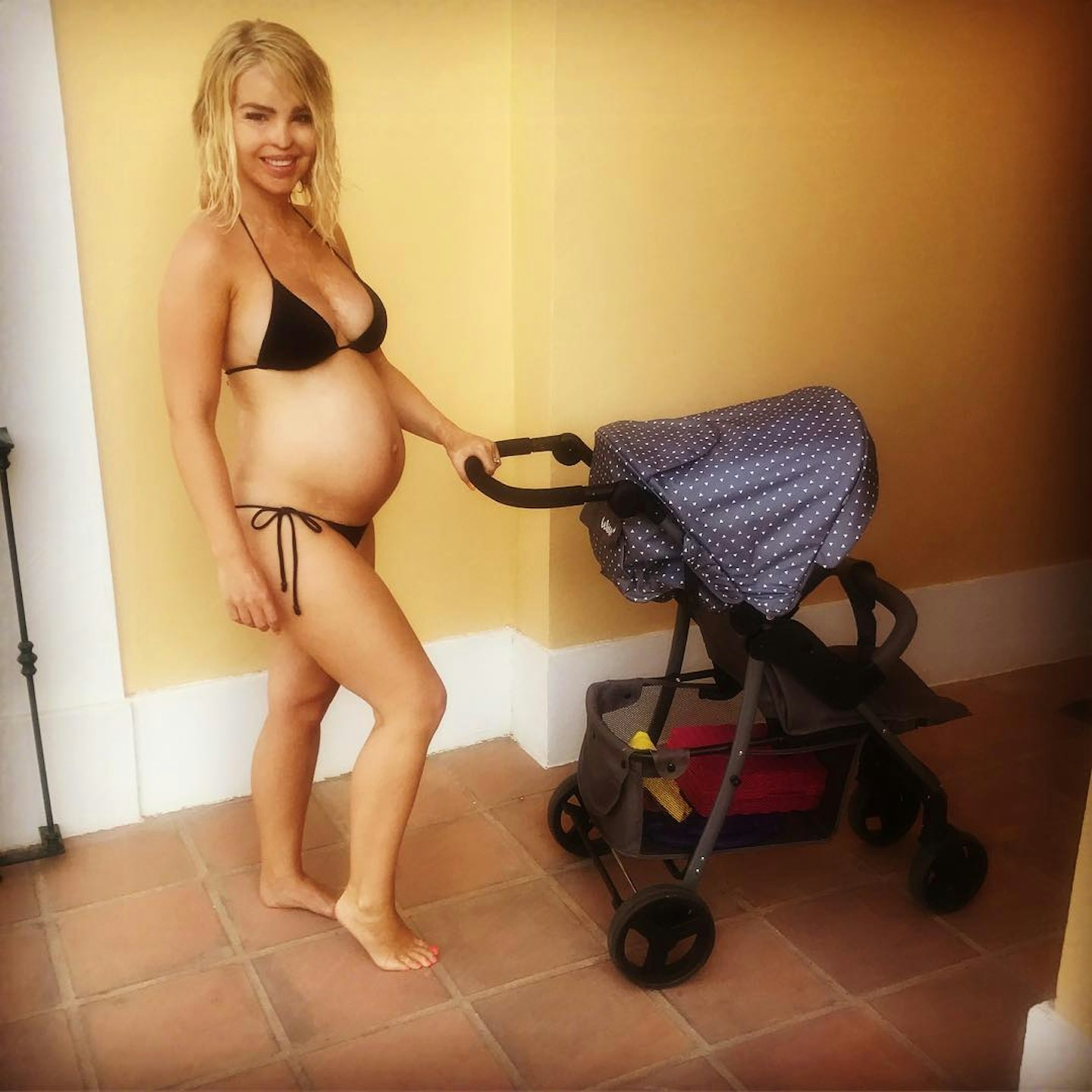 katie-piper-forced-caesarean-second-pregnancy-scarring