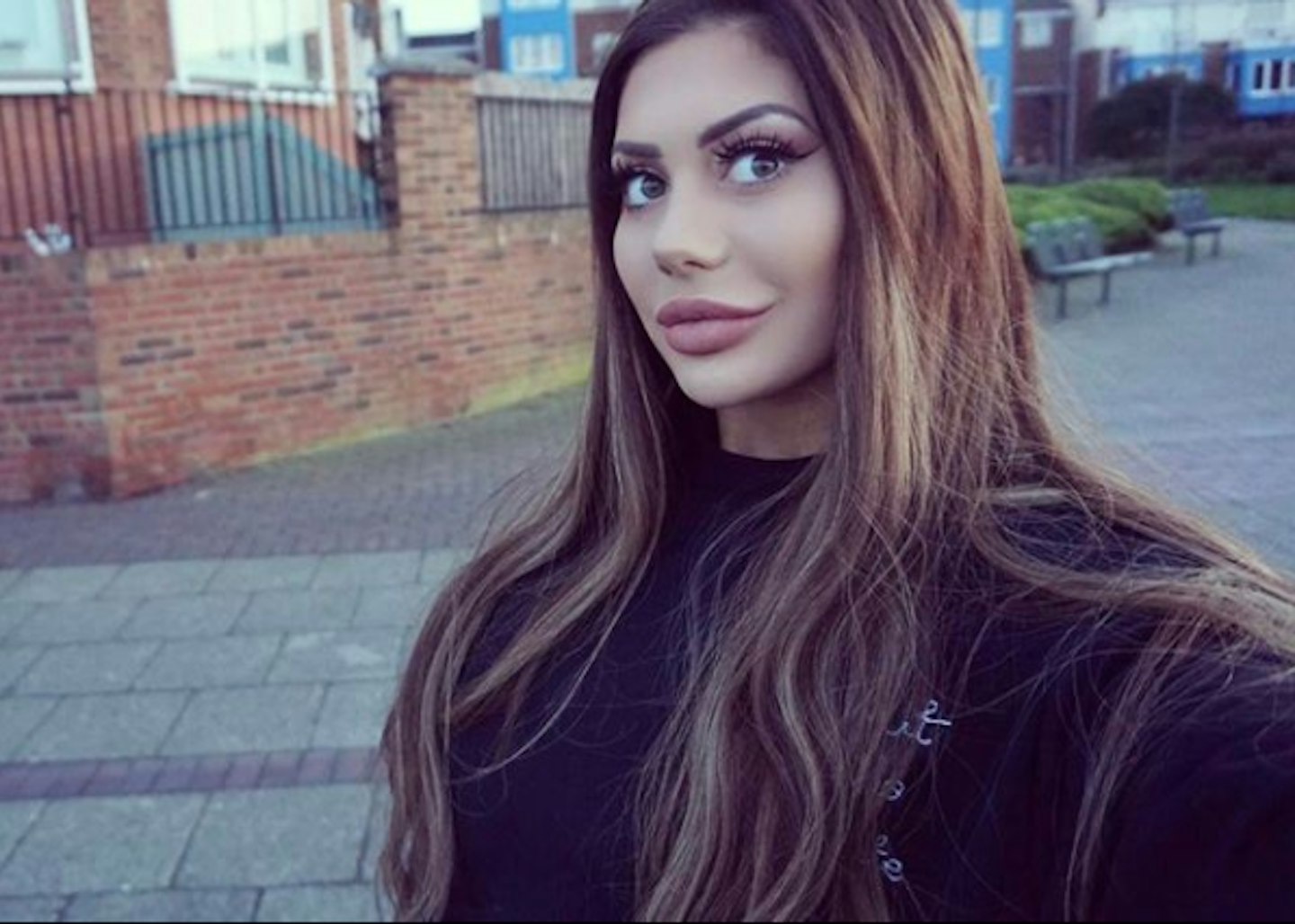 Chloe Ferry nose job 