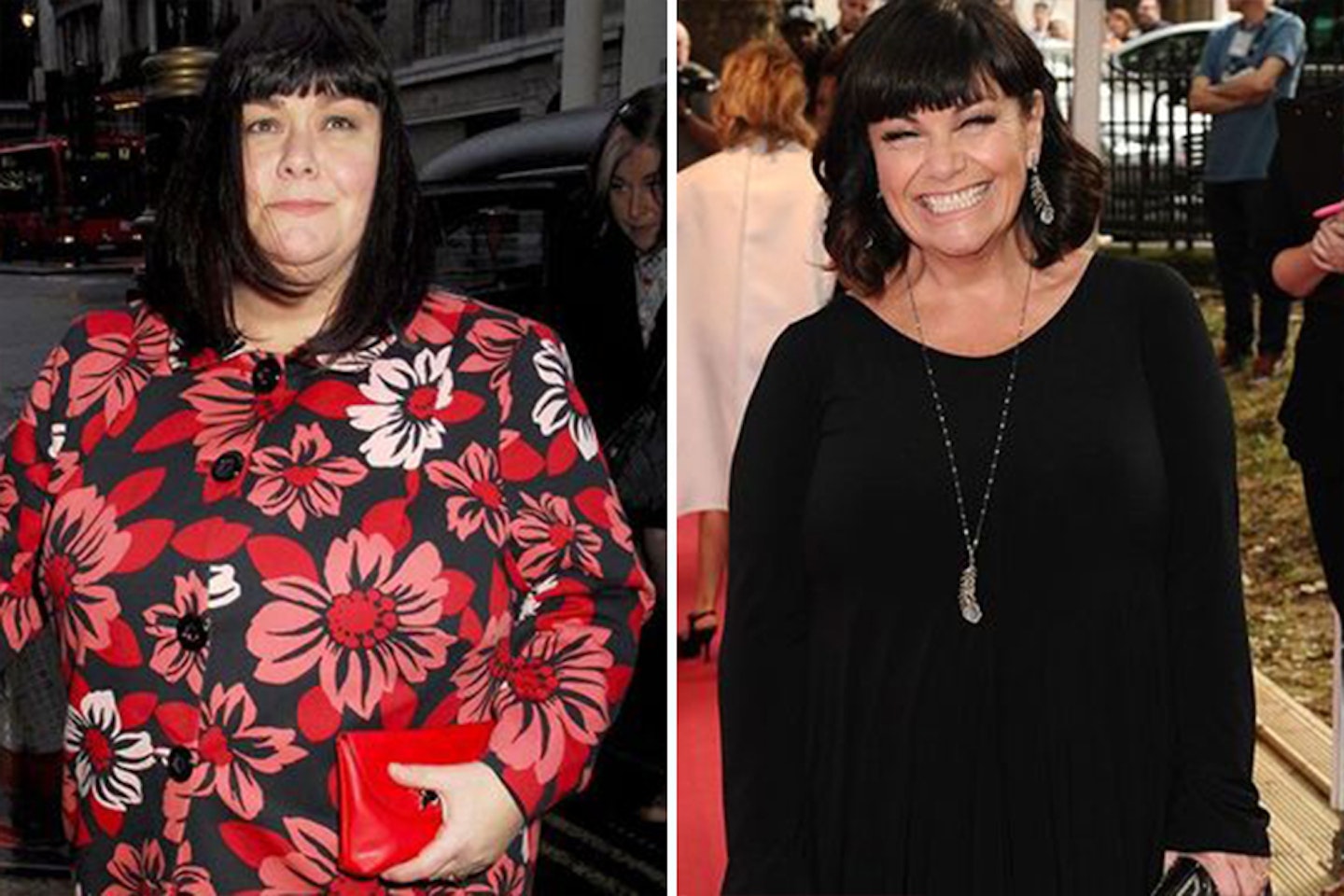 dawn-french-looks-age-weight-loss