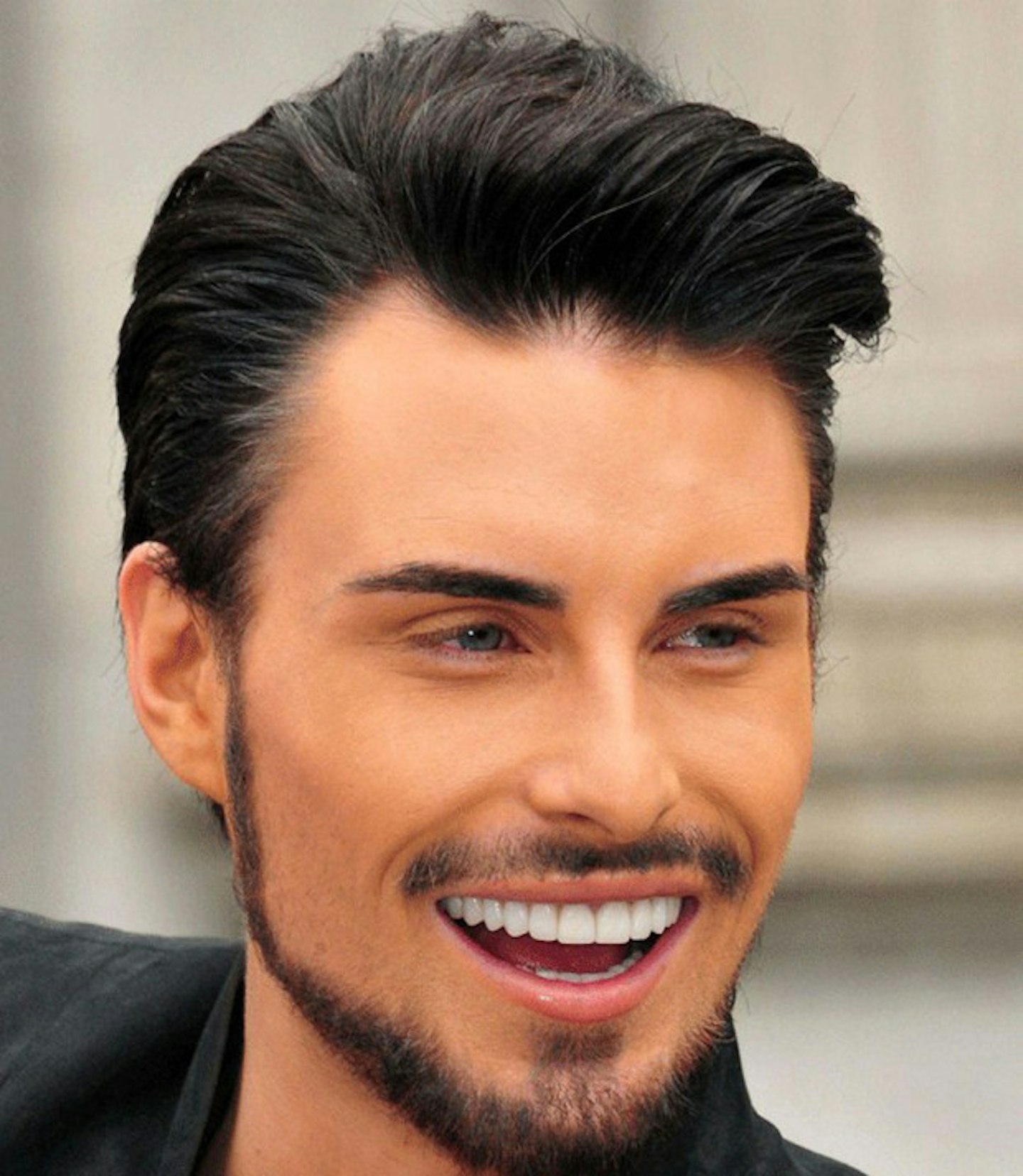 Rylan-Clark-teeth-after-picture