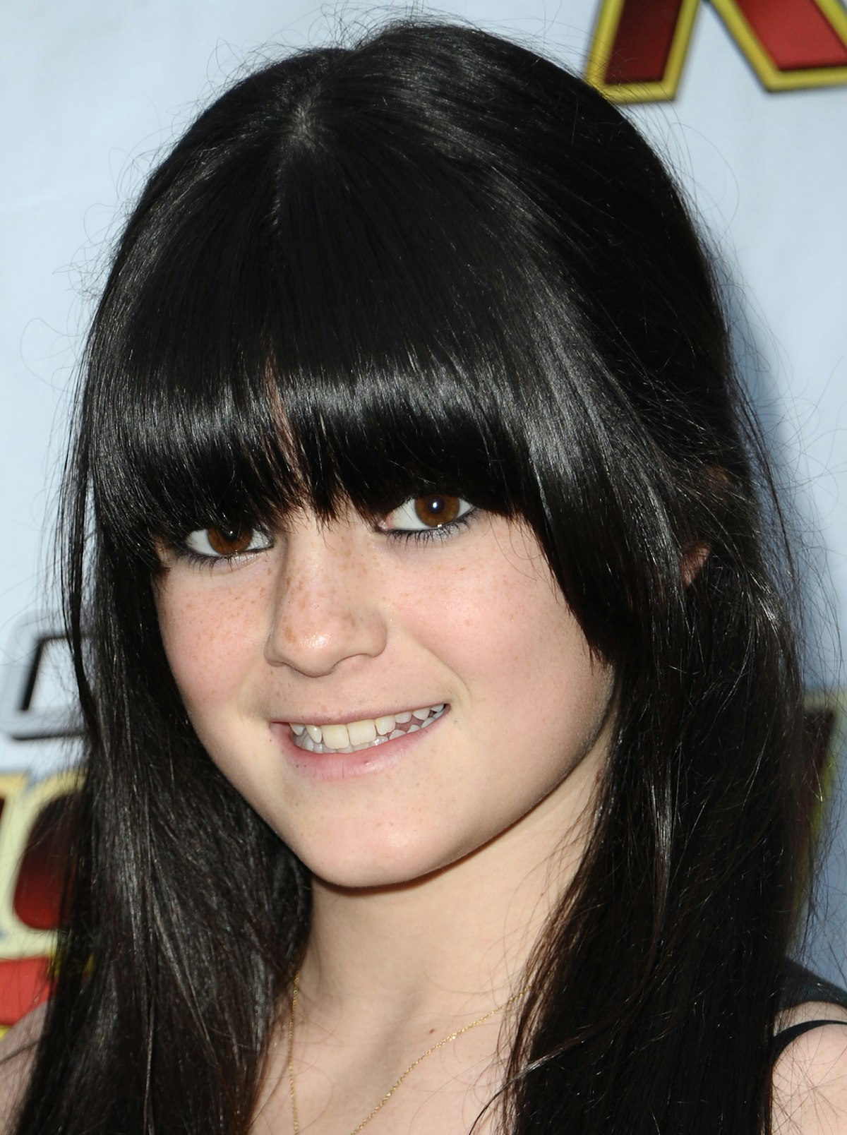 Kylie Jenner Before And After Bbl - wgn398p