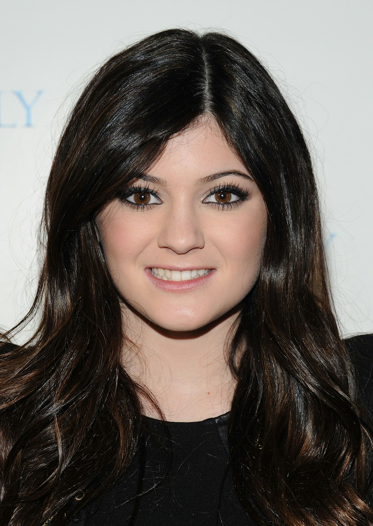 Kylie Jenner Before And After Bbl - cla6cep