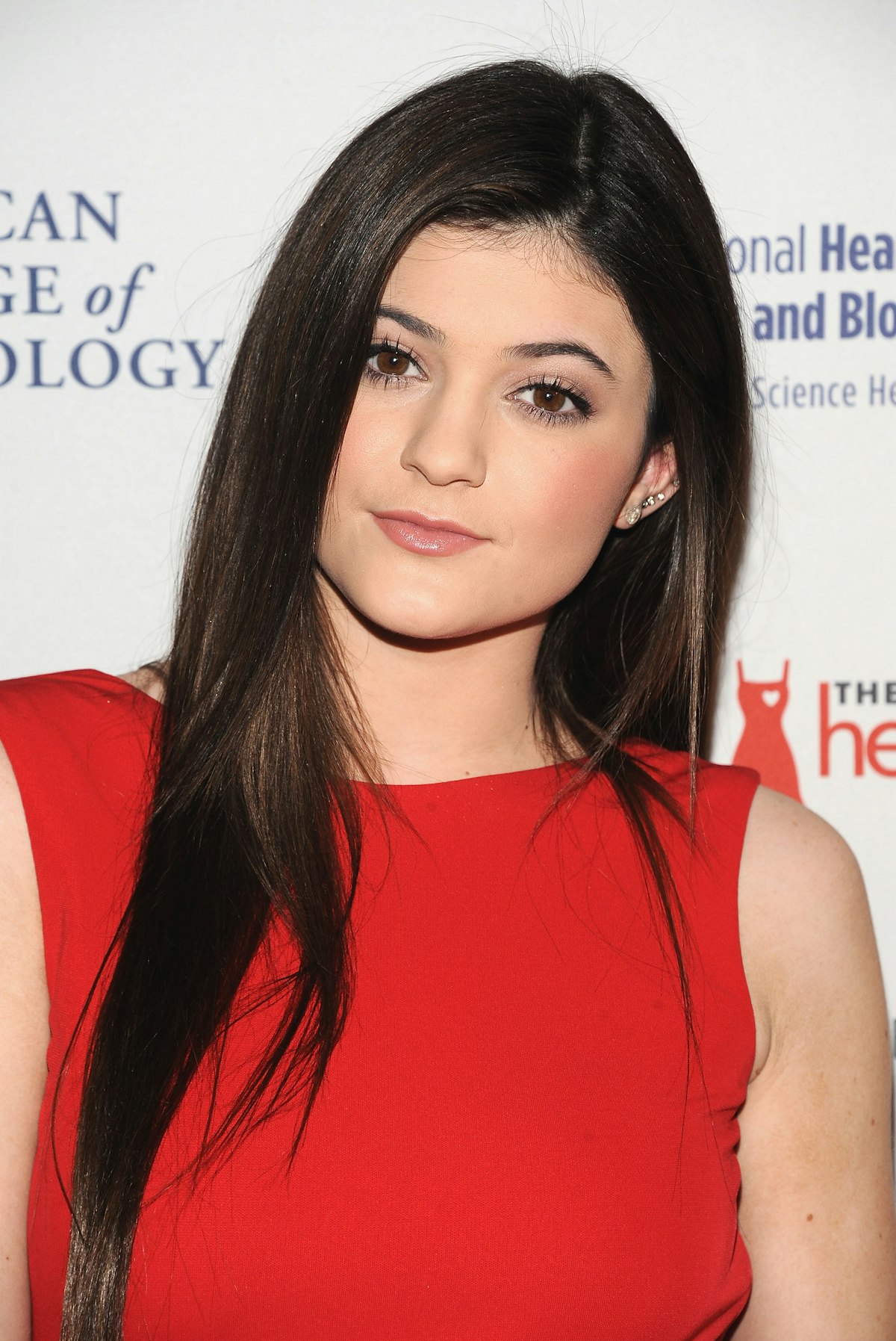 Kylie Jenner Before And After Bbl - jahov7y